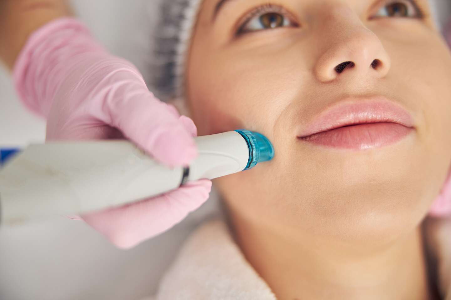 Hydrodermabrázia - TOP ošetrenie pre čistú a dokonalú pleť – Obrázok 2