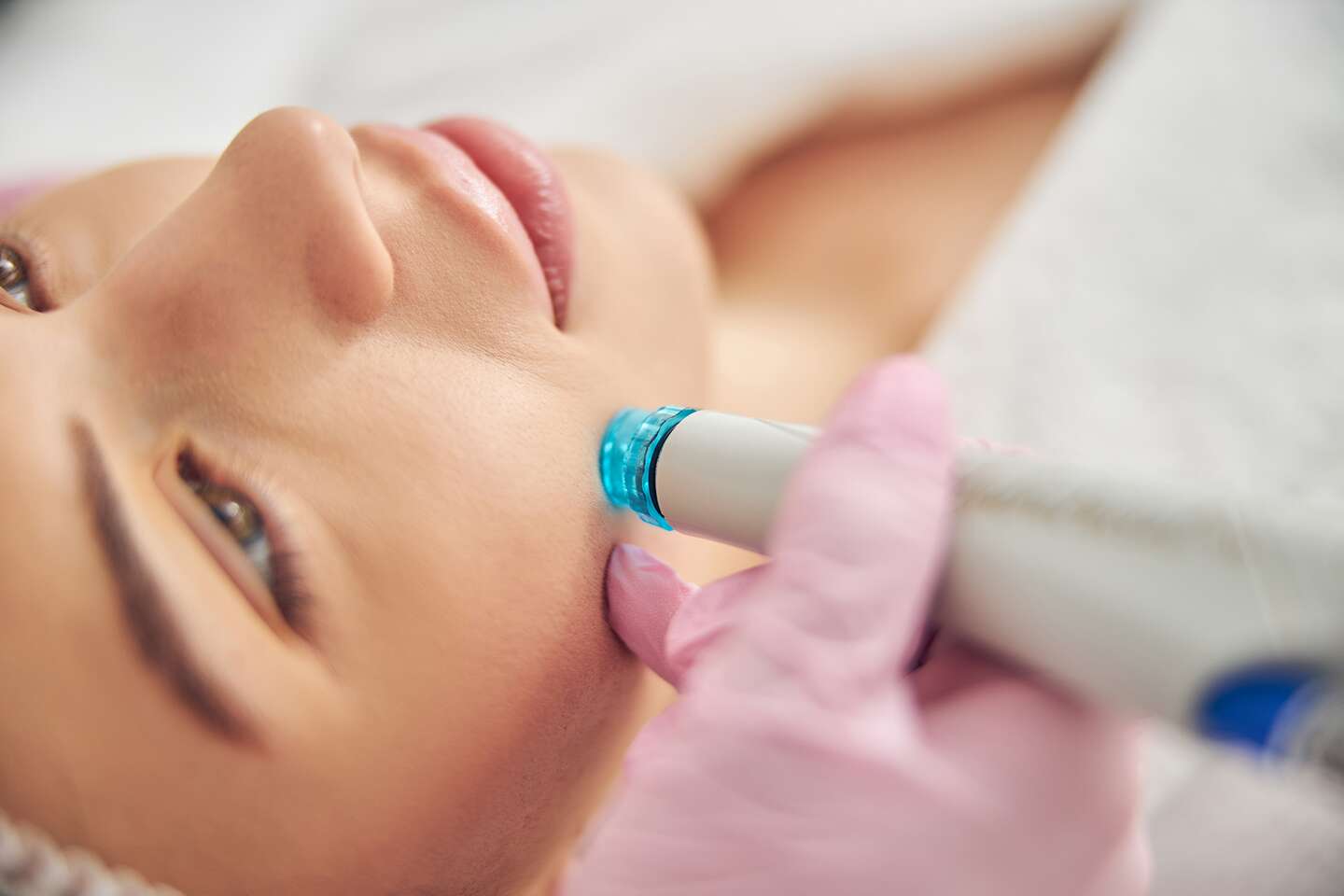 Hydrodermabrázia - TOP ošetrenie pre čistú a dokonalú pleť – Obrázok 3