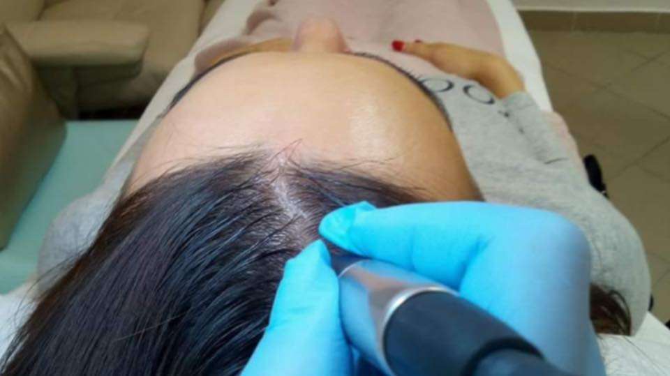 Prístrojová mezoterapia pre hustejšie a zdravšie vlasy v salóne ELEONOR ESTHETIC – Obrázok 6