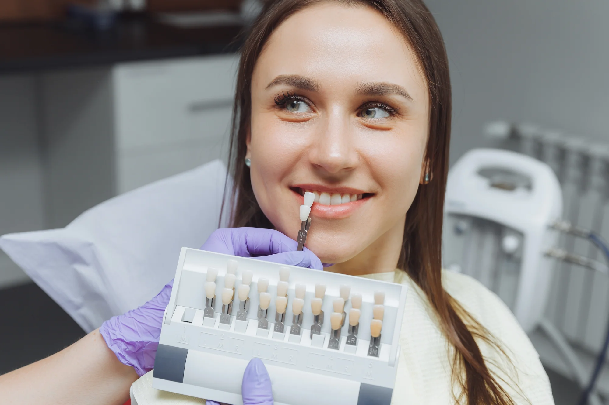 Bielenie zubov Purewhitening: kombinovaná procedúra v ambulancii aj doma – Obrázok 3