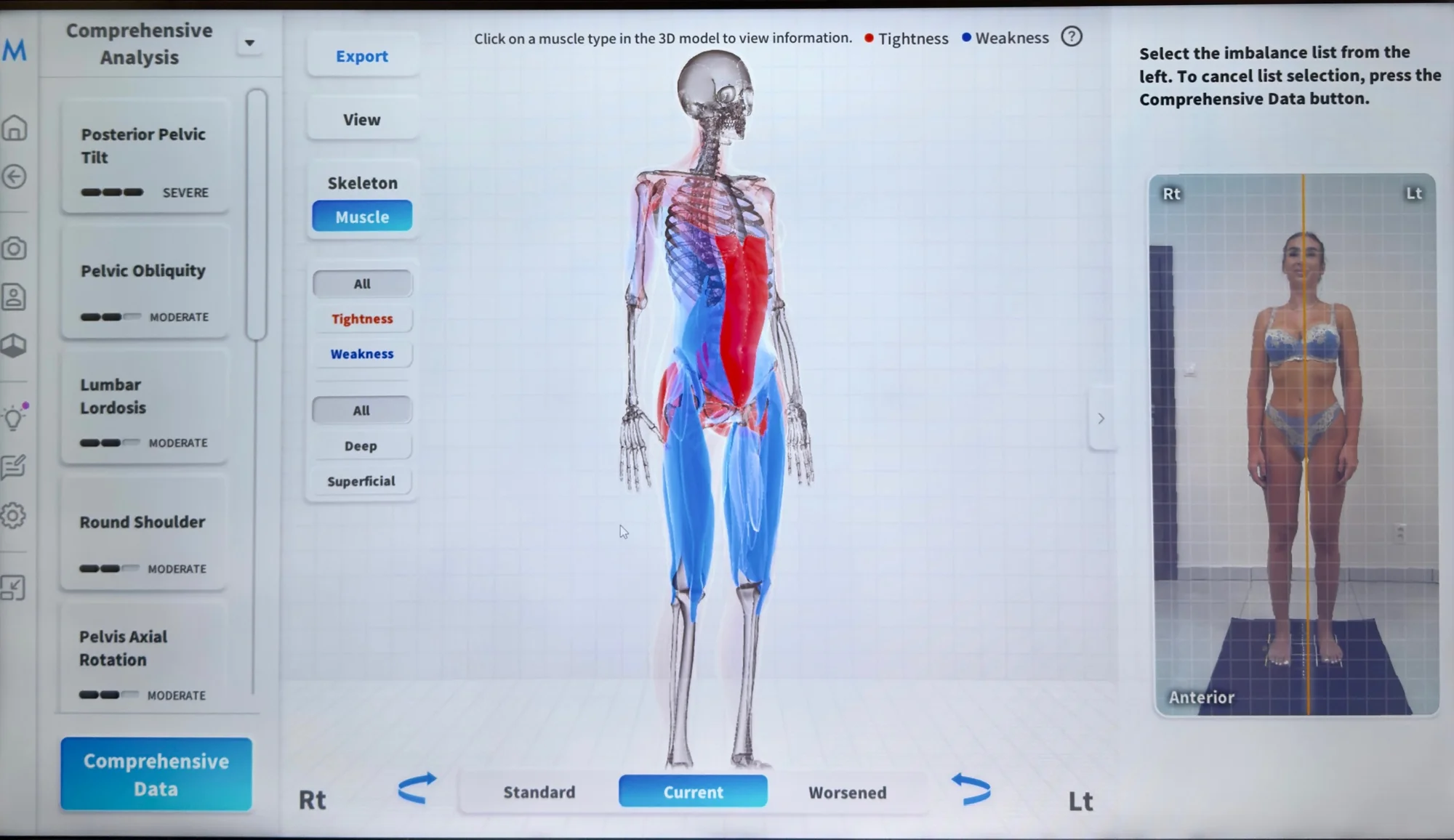 Diagnostika pohybového aparátu revolučnou technológiou Moti Physio – Obrázok 4