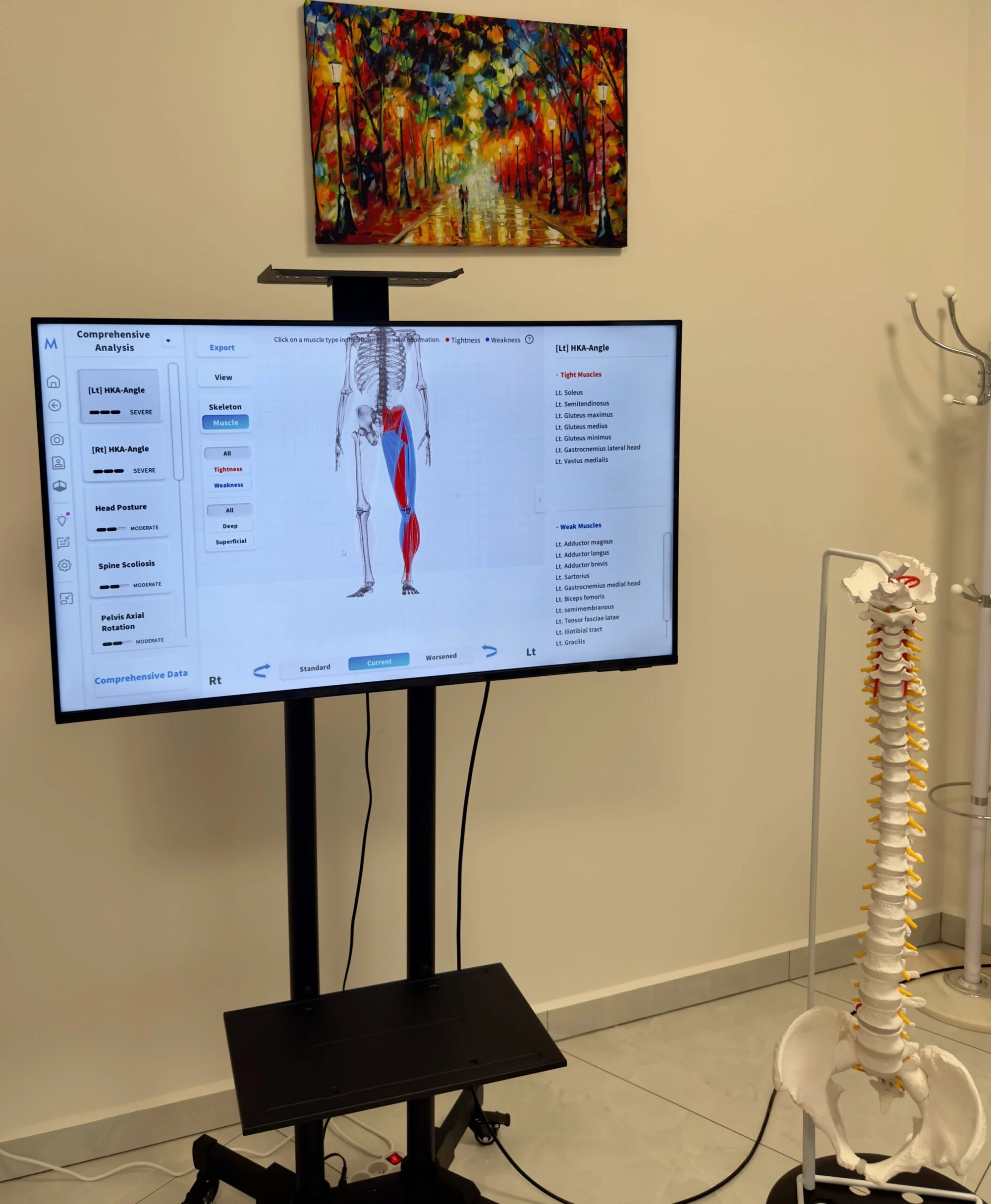 Diagnostika pohybového aparátu revolučnou technológiou Moti Physio – Obrázok 6