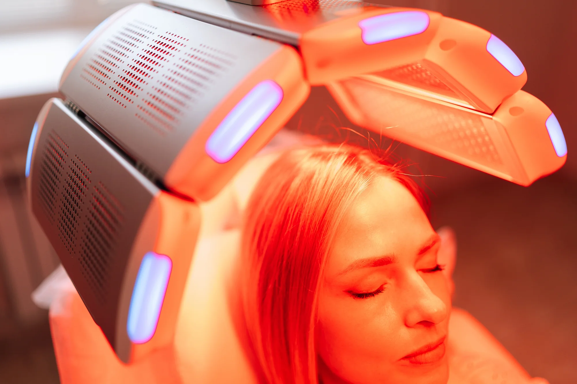 Brilliance Hair Therapy – laserová vlasová terapia novej generácie – Obrázok 2
