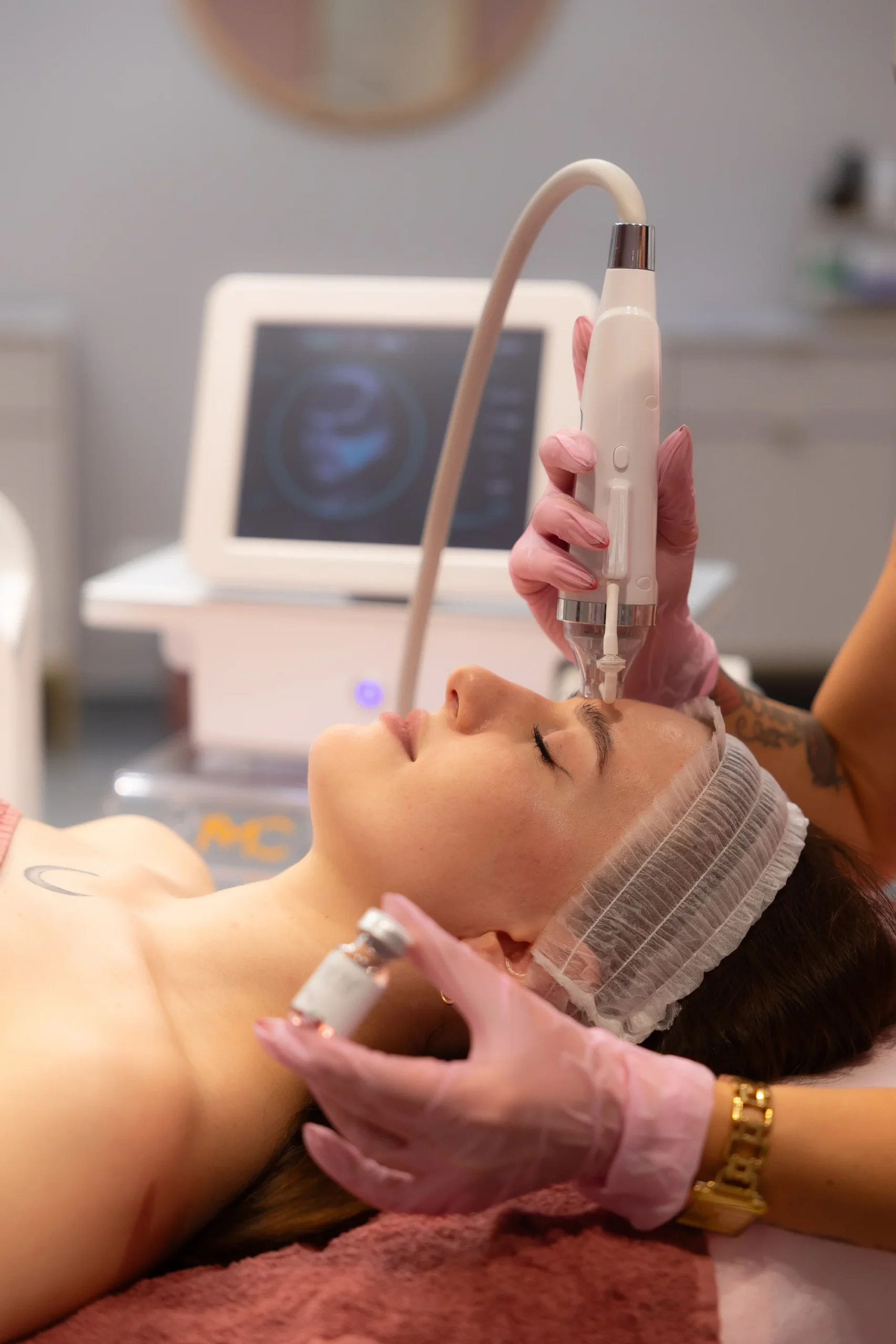 Čistenie pleti hydradermabráziou alebo mikroihličková rádiofrekvencia na omládenie – Obrázok 4