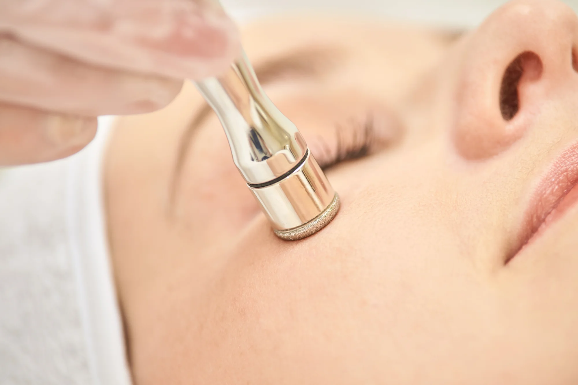 FACE CLEAN: Diamantová mikrodermabrázia a kyslíková terapia krku a dekoltu alebo celej tváre – Obrázok 2