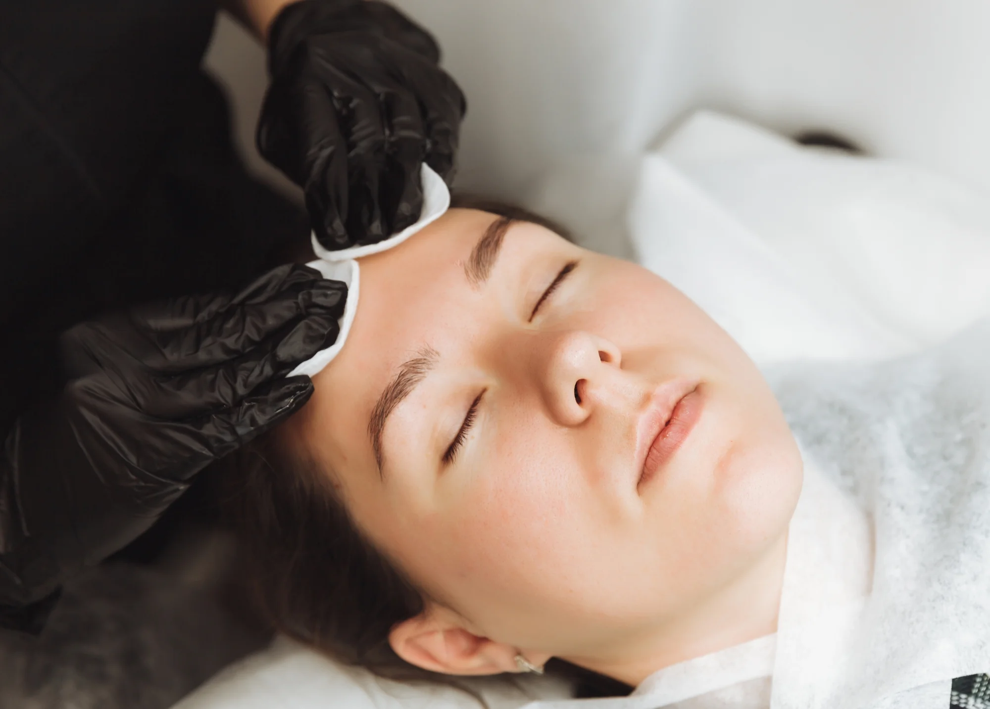 Kozmetické ošetrenia: dermaplaning pre hladkú a sviežu pleť a mezoterapia – Obrázok 6