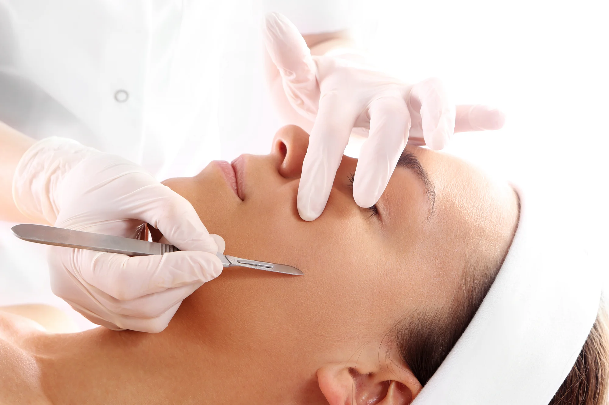 Kozmetické ošetrenia: dermaplaning pre hladkú a sviežu pleť a mezoterapia – Obrázok 3