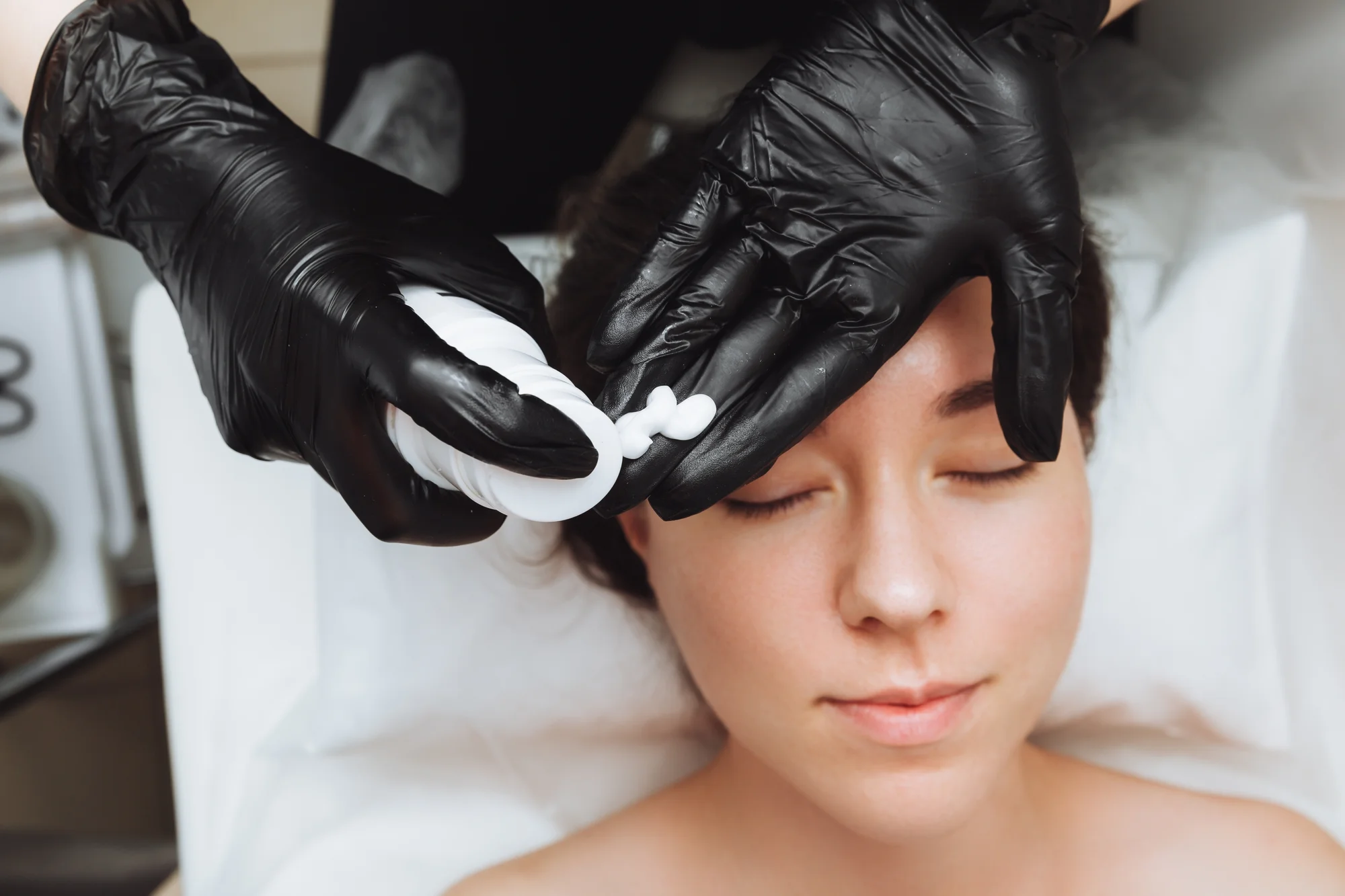 Kozmetické ošetrenia: dermaplaning pre hladkú a sviežu pleť a mezoterapia – Obrázok 5