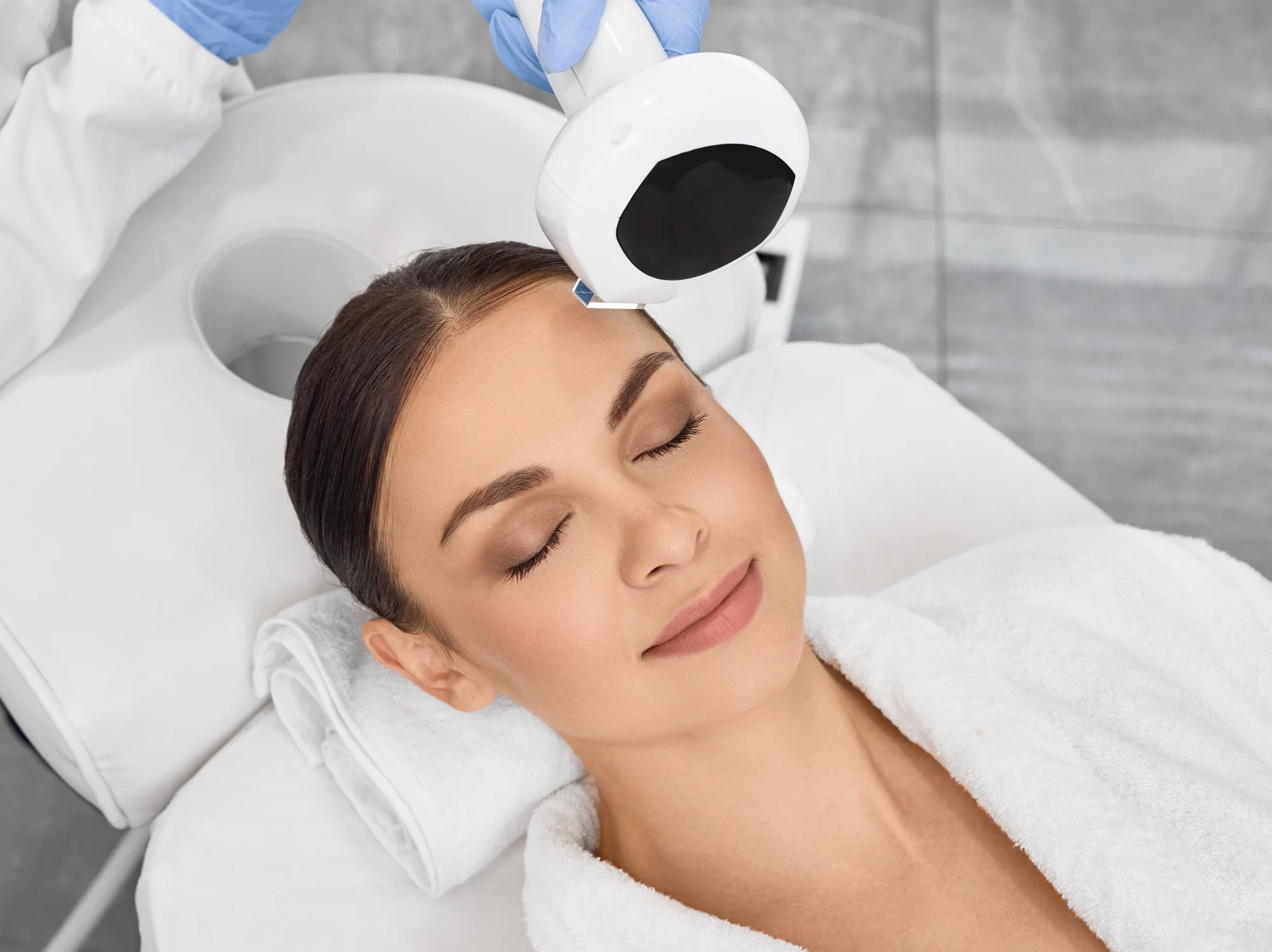 4D fotorejuvenizácia tváre: metóda na omladenie pleti – Obrázok 3