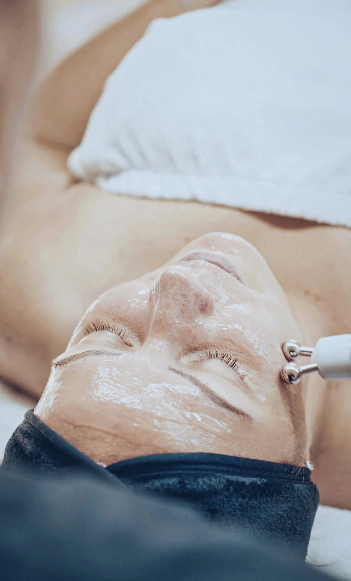 Deluxe liftingové ošetrenie pleti či chemický peeling – Obrázok 6