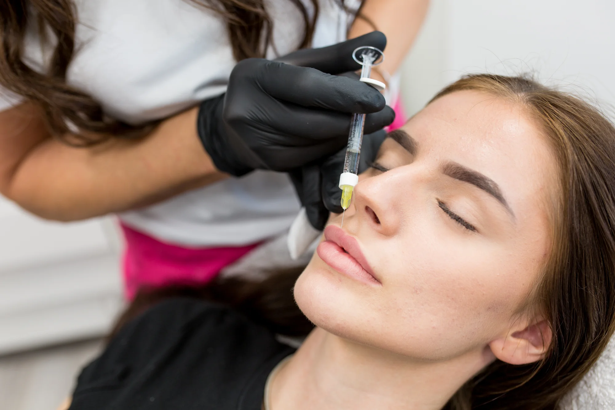 Výplň pier, contouring kyselinou alebo redukcia vrások pomocou Botoxu – Obrázok 3