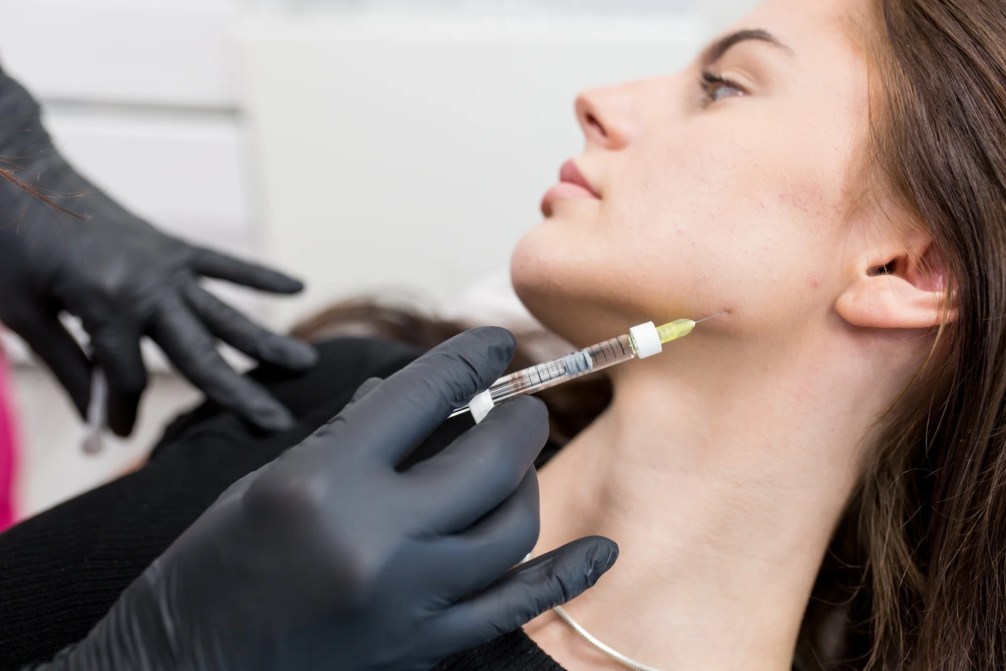 Výplň pier, contouring kyselinou alebo redukcia vrások pomocou Botoxu – Obrázok 6