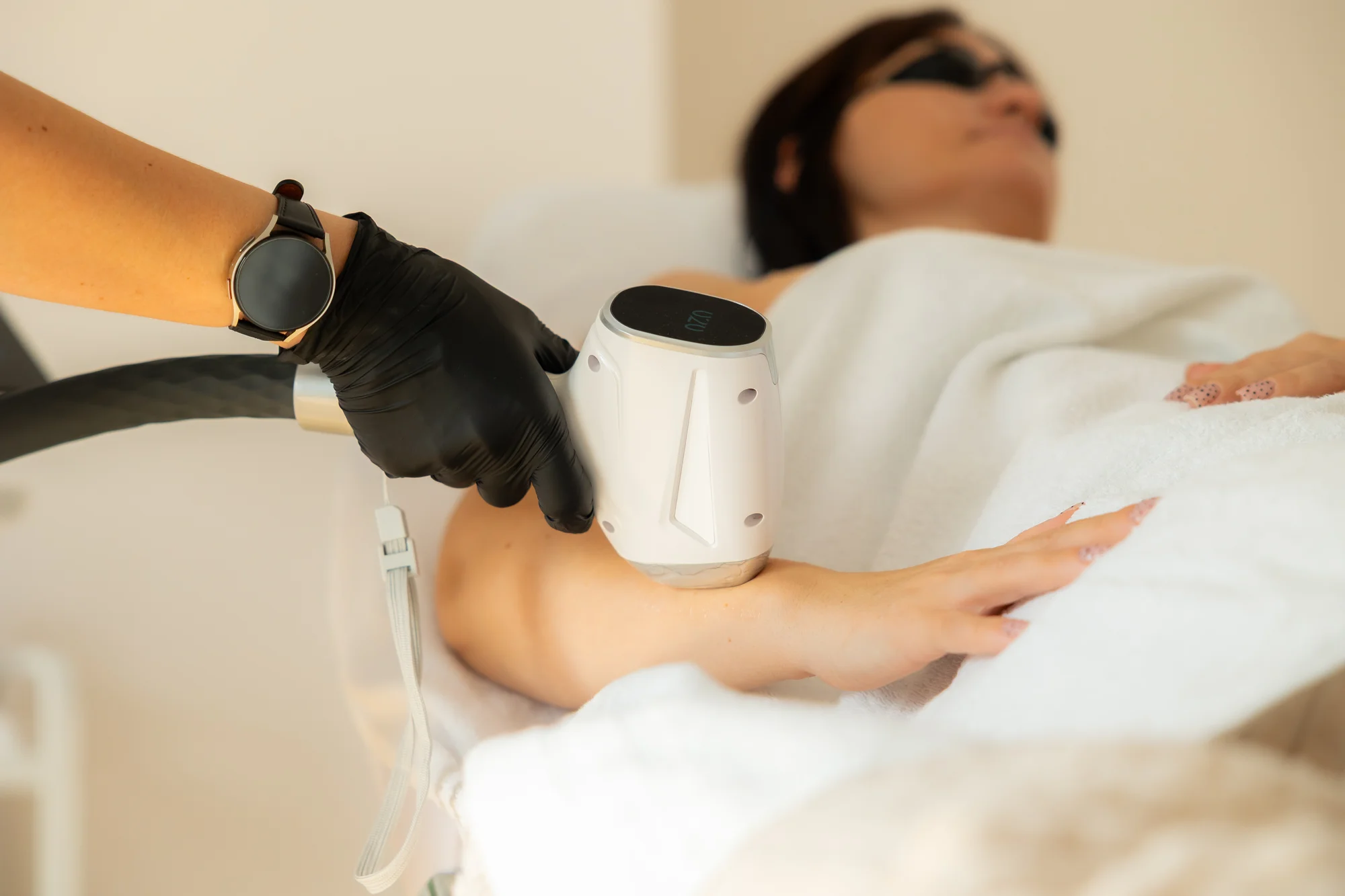 Laserová epilácia rôznych partií: nohy, ruky, bikini, podpazušie, brucho či horná pera – Obrázok 4