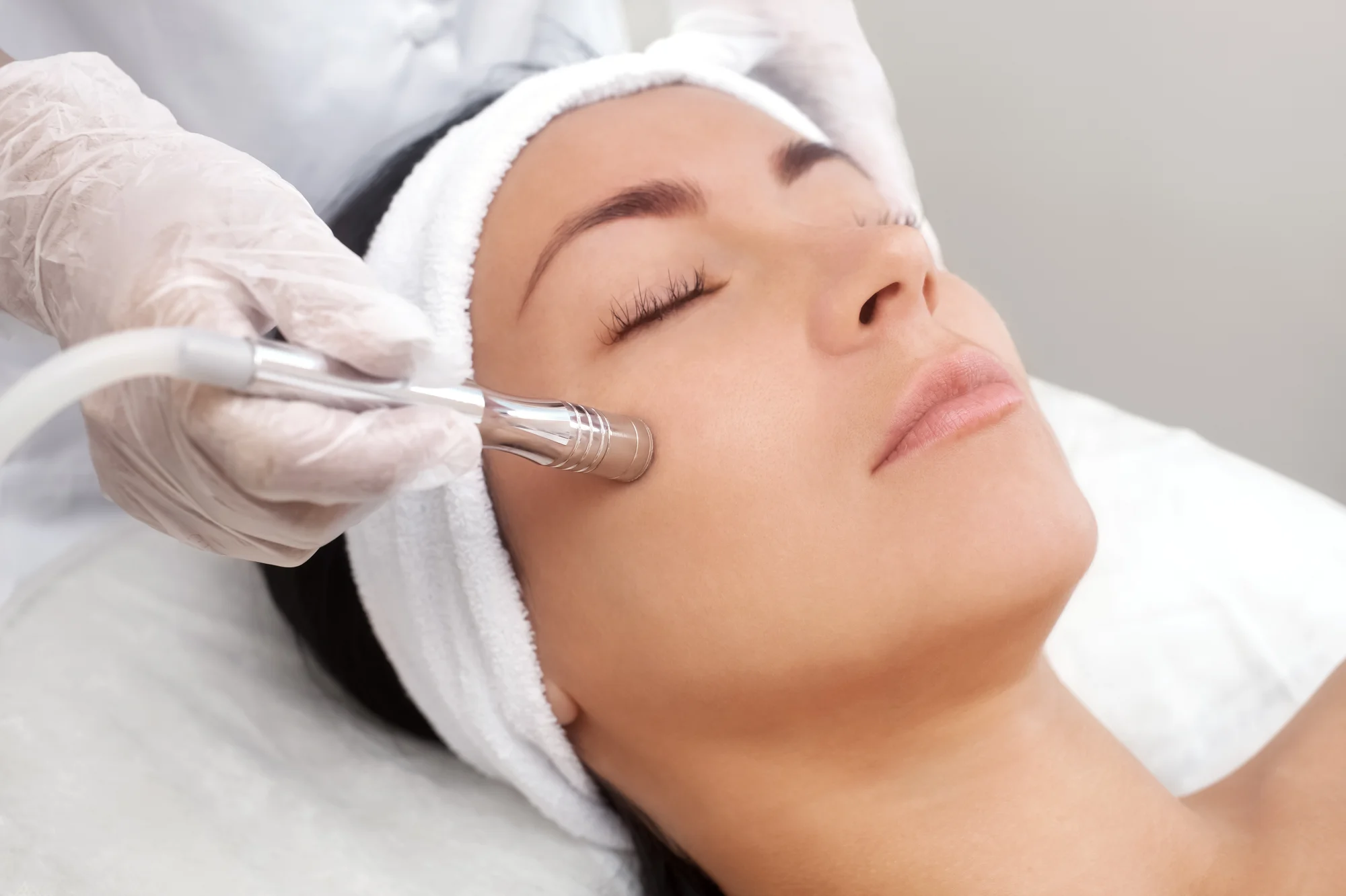 Hĺbkové čistenie, vodná dermabrázia, lifting pleti pomocou rádiofrekvencie alebo rádiomezolift – Obrázok 5