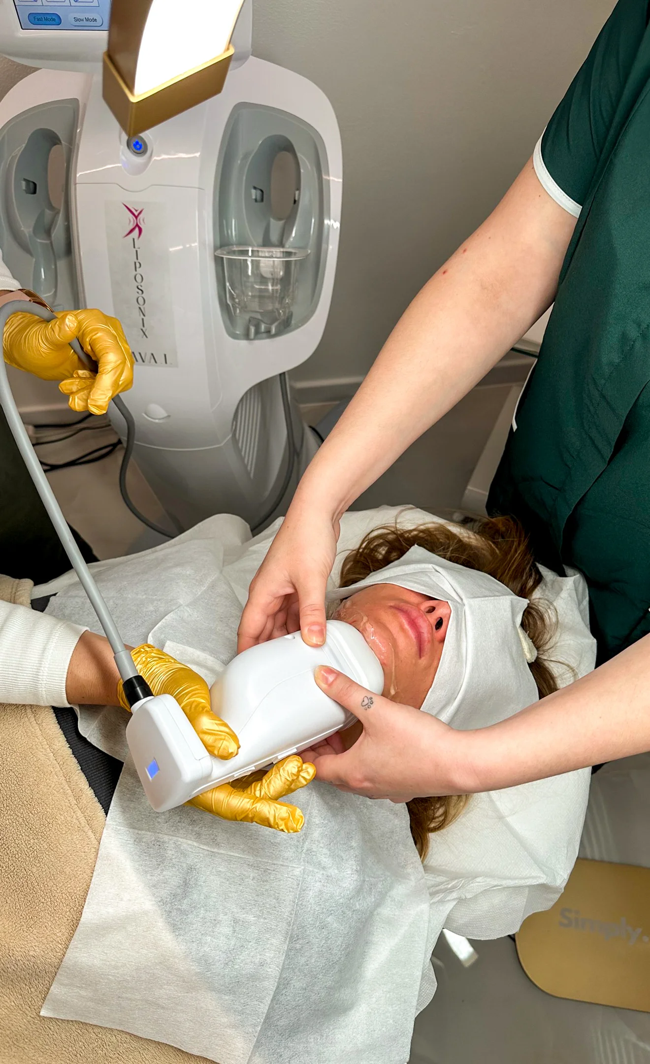 Neinvazívna liposukcia ultrazvukom Liposonix AVA .I. – Obrázok 3