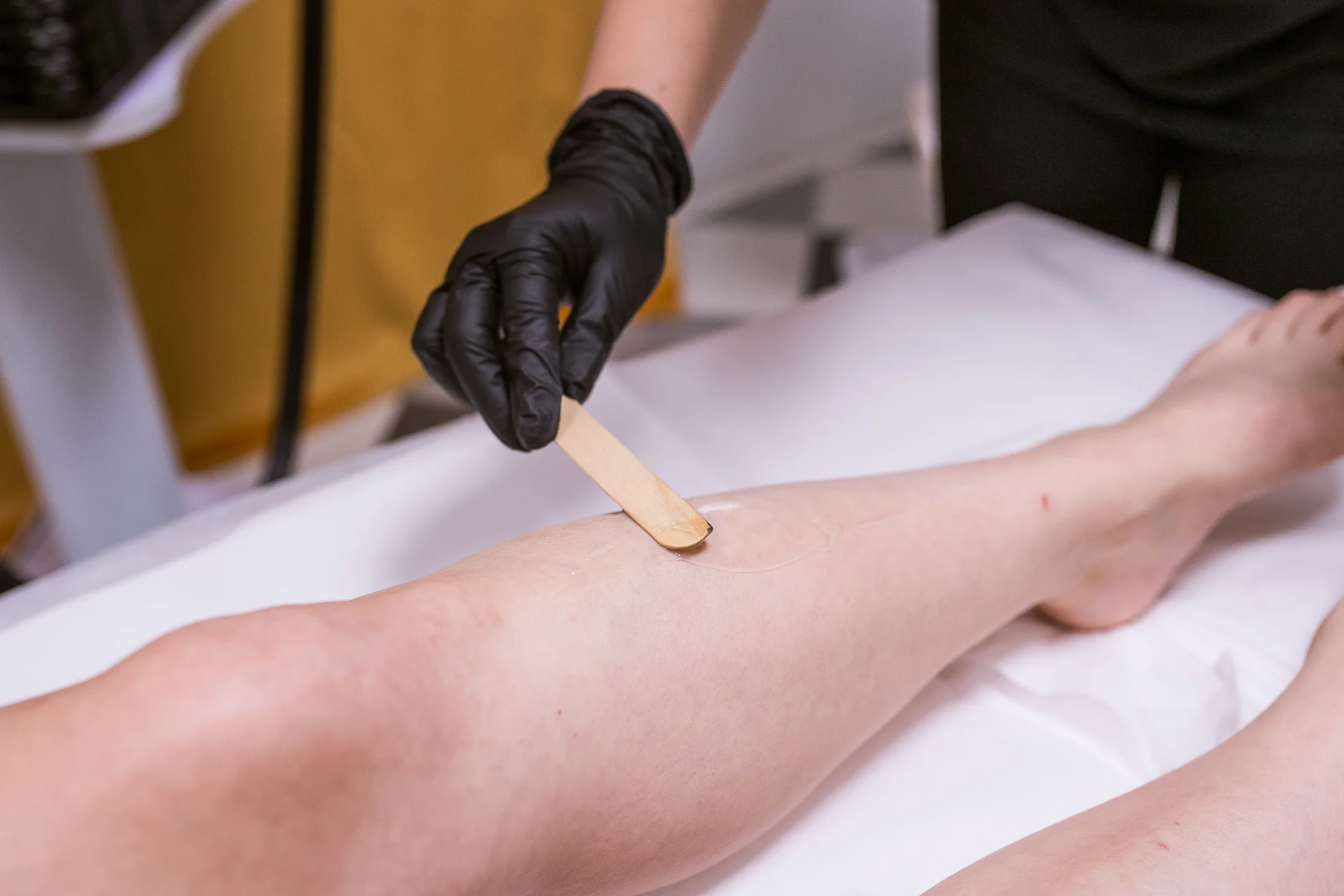 Odstránenie ochlpenia pomocou vysoko výkonného diódového lasera – Obrázok 2