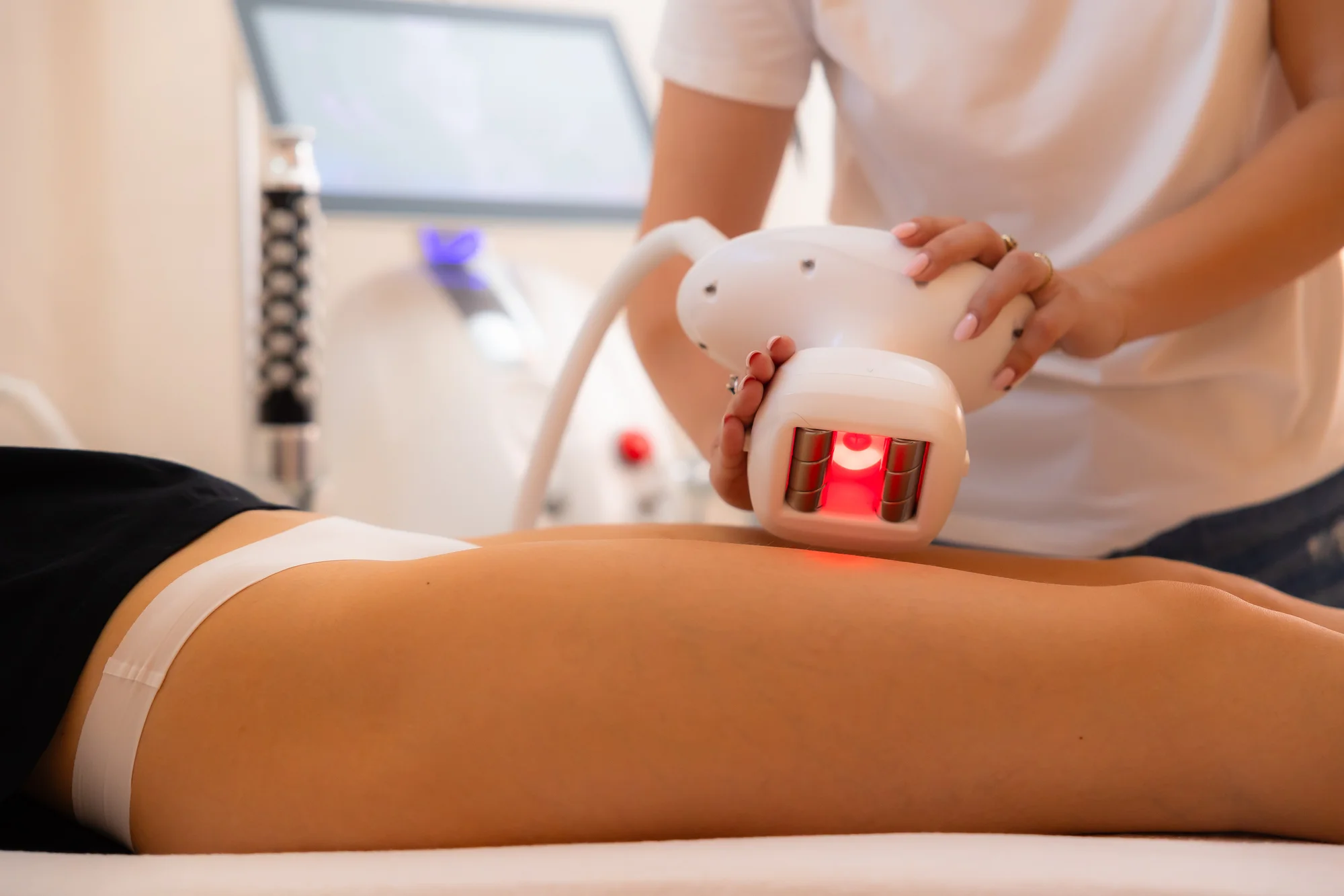 Ošetrenie VelaShape pre redukciu celulitídy a spevnenie pokožky – Obrázok 2