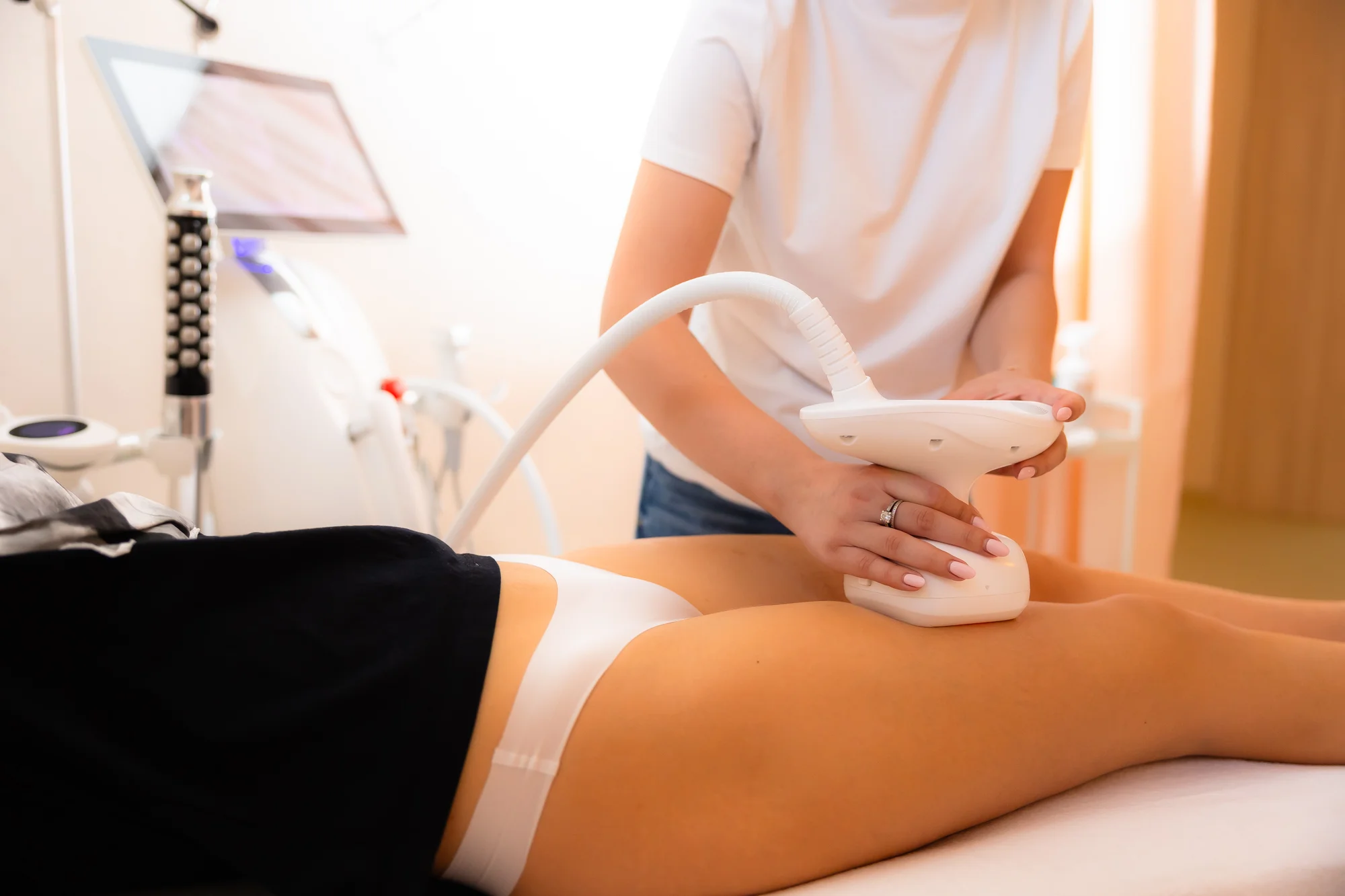 Ošetrenie VelaShape pre redukciu celulitídy a spevnenie pokožky – Obrázok 4