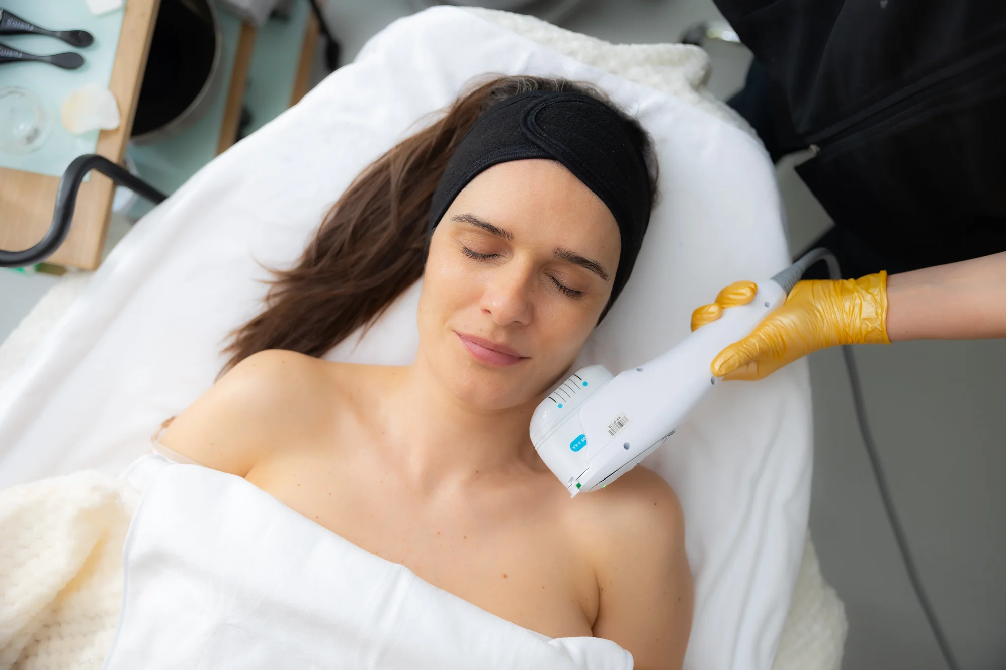Omladenie bez skalpela: Účinný neinvazívny HIFU lifting tváre či podbradku – Obrázok 2
