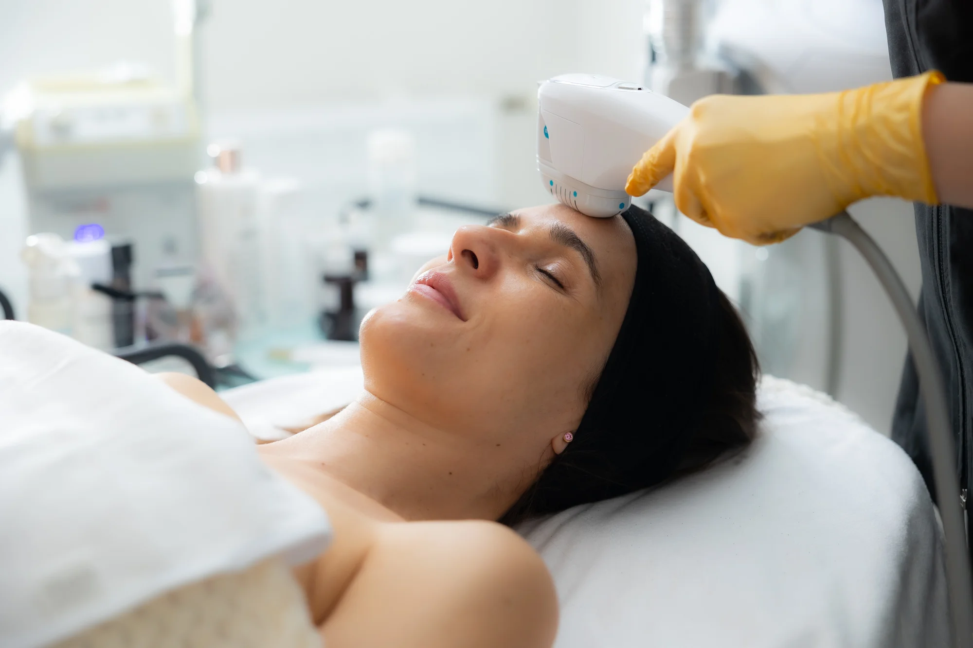 Omladenie bez skalpela: Účinný neinvazívny HIFU lifting tváre či podbradku – Obrázok 3