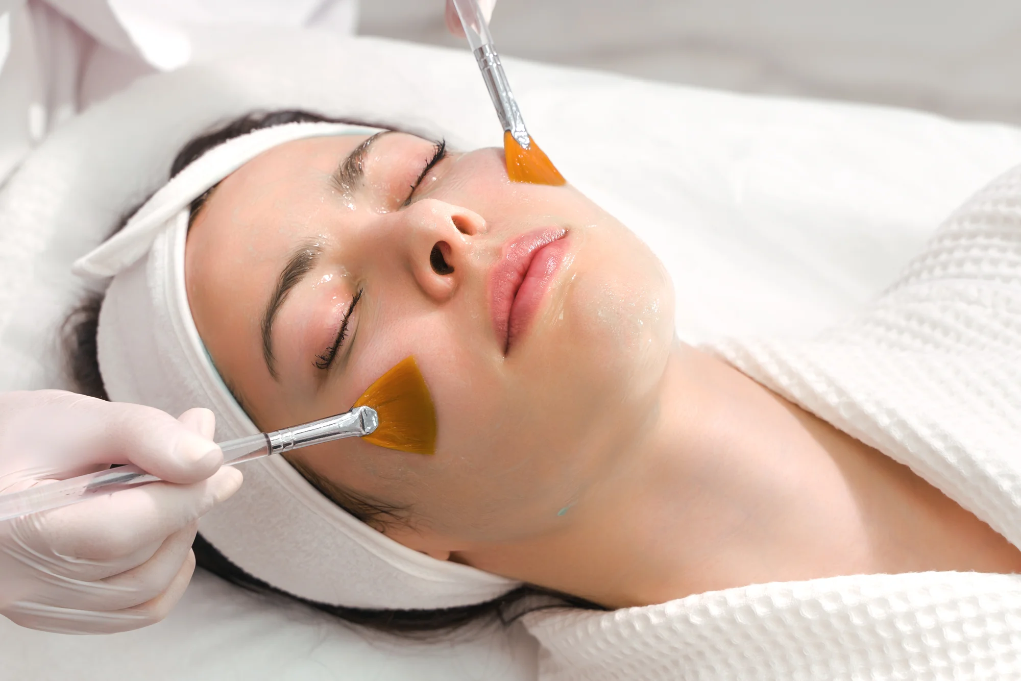 Kozmetické ošetrenia: Hydratačné, protizápalové, chemický peeling, microneedling a i. – Obrázok 3