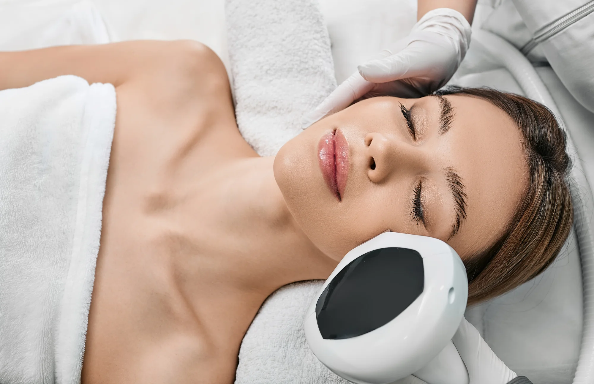 4D fotorejuvenizácia tváre: metóda na omladenie pleti – Obrázok 4