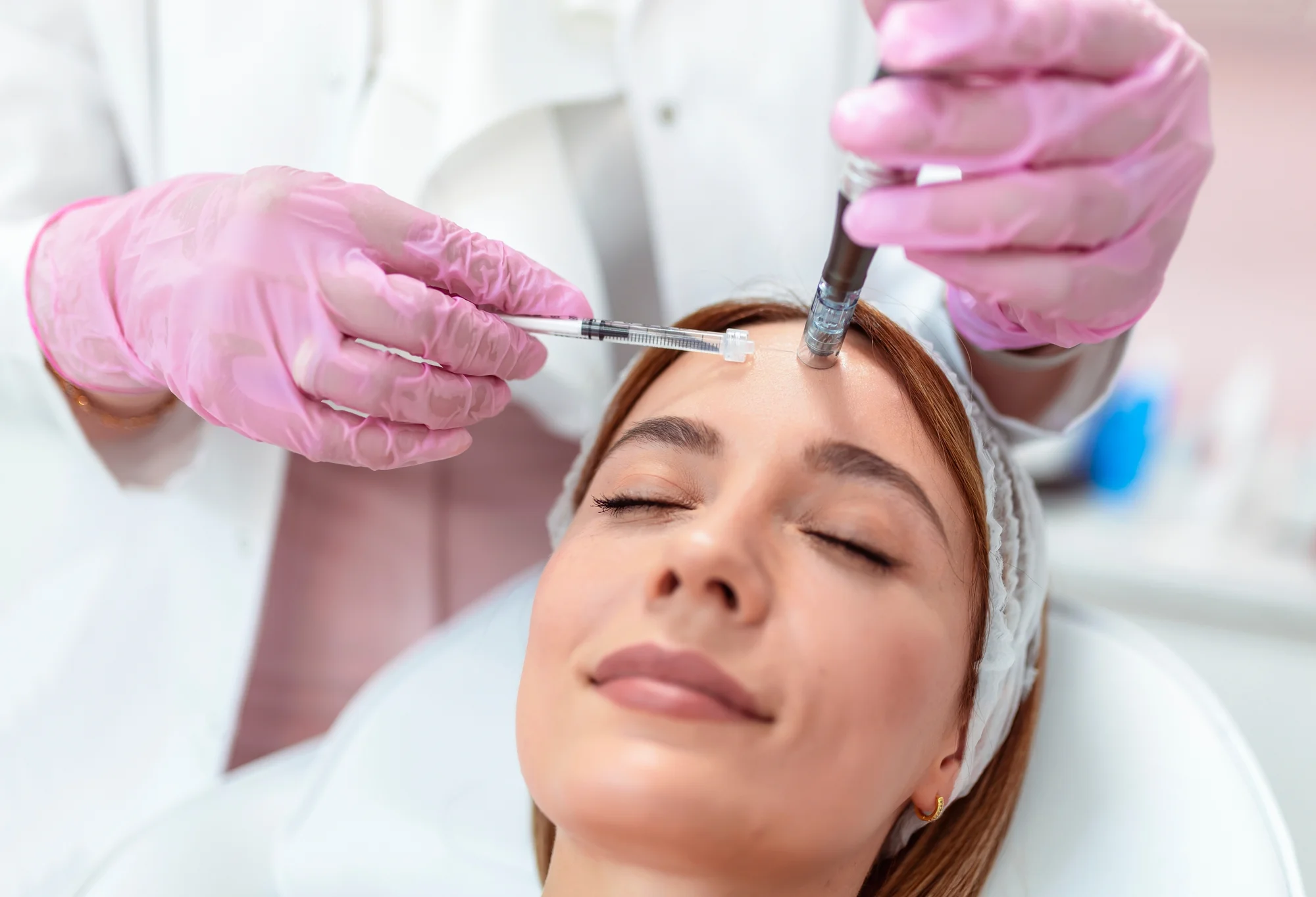 Účinná mezoterapia alebo bioregenerácia microneedling očného okolia – Obrázok 5