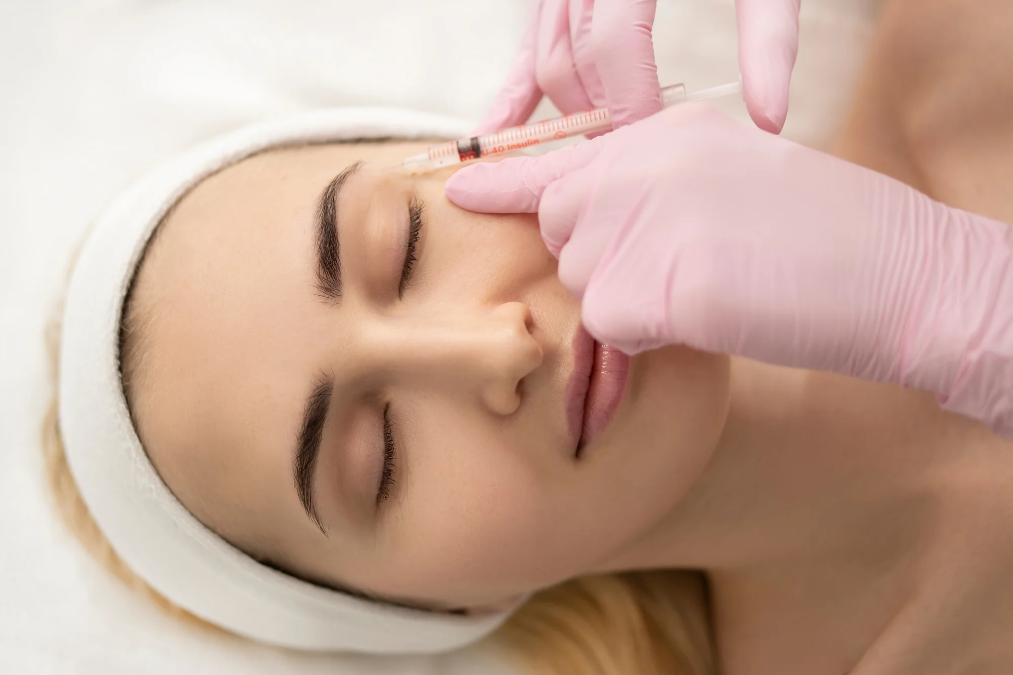 Účinná mezoterapia alebo bioregenerácia microneedling očného okolia – Obrázok 4