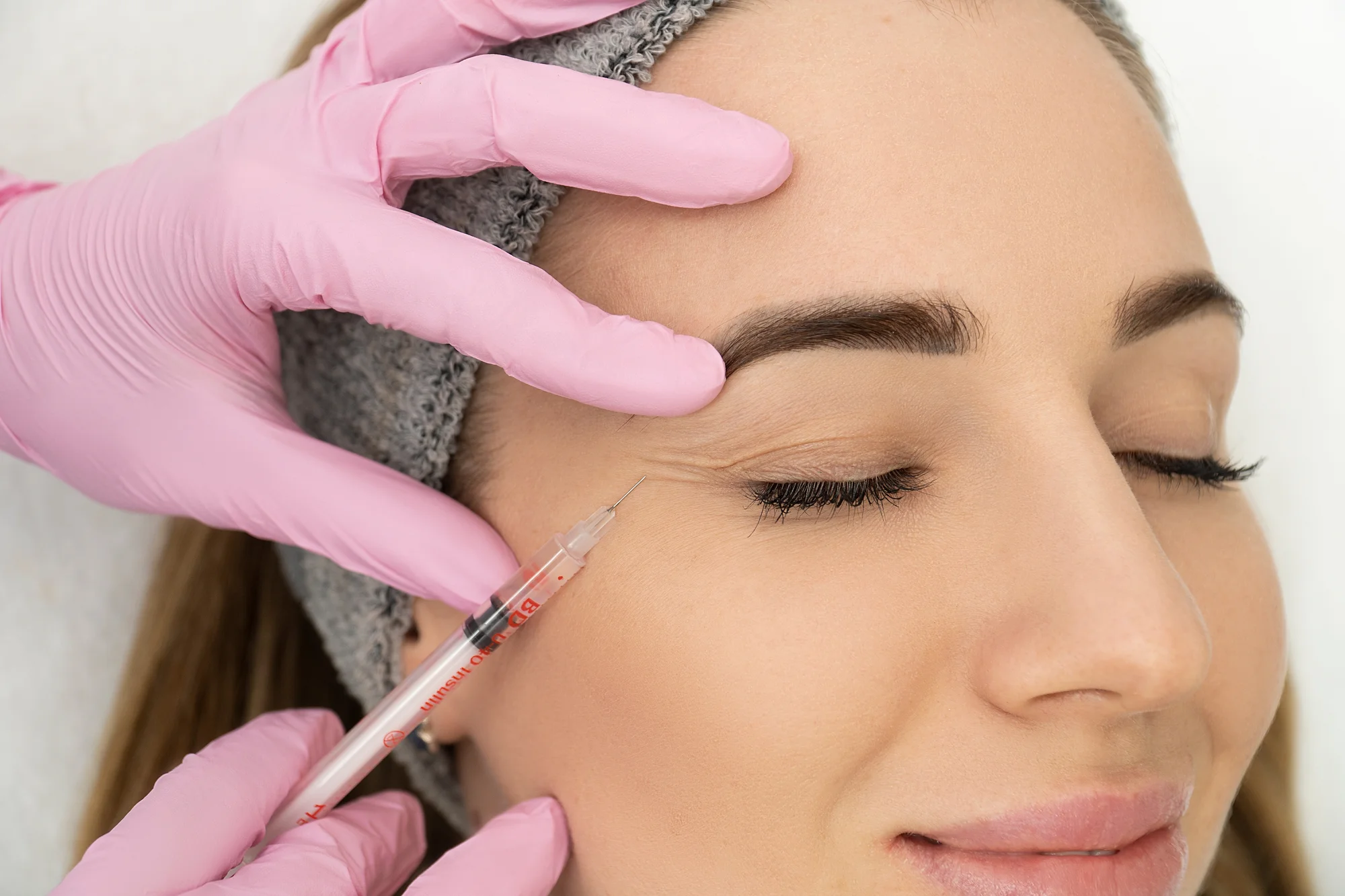 Účinná mezoterapia alebo bioregenerácia microneedling očného okolia – Obrázok 2