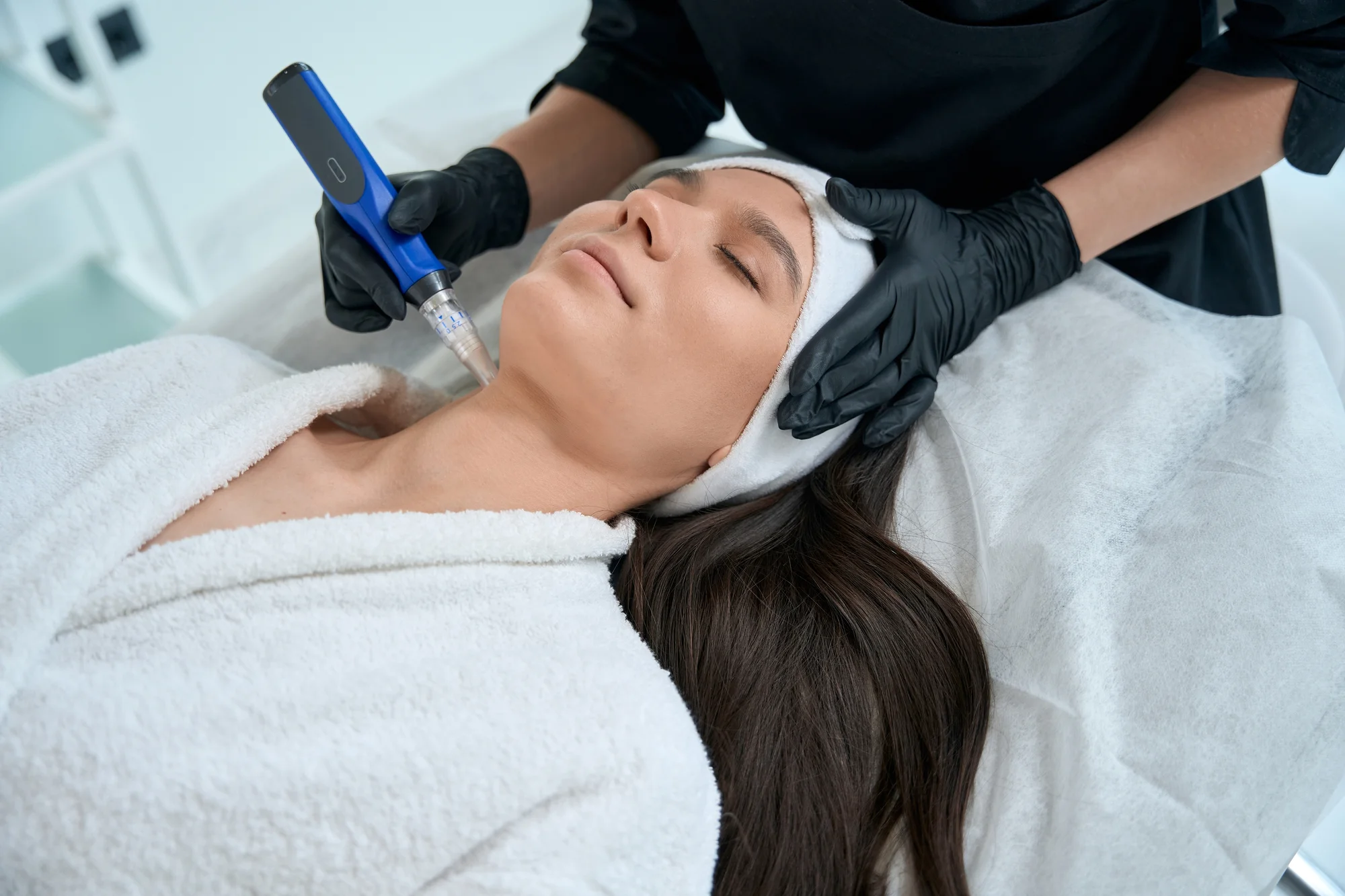Mezoterapia dermapenom na omladenie či boj s akné v kozmetickom salóne Beauty, aj permanentky – Obrázok 4
