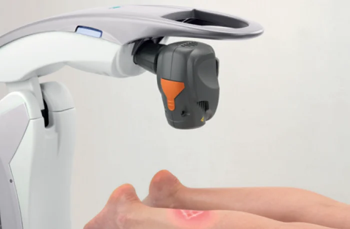 Terapia MLS Laserom alebo elektromagnetickým stimulátorom: Zmiernenie bolesti, opuchov a zápalov – Obrázok 4