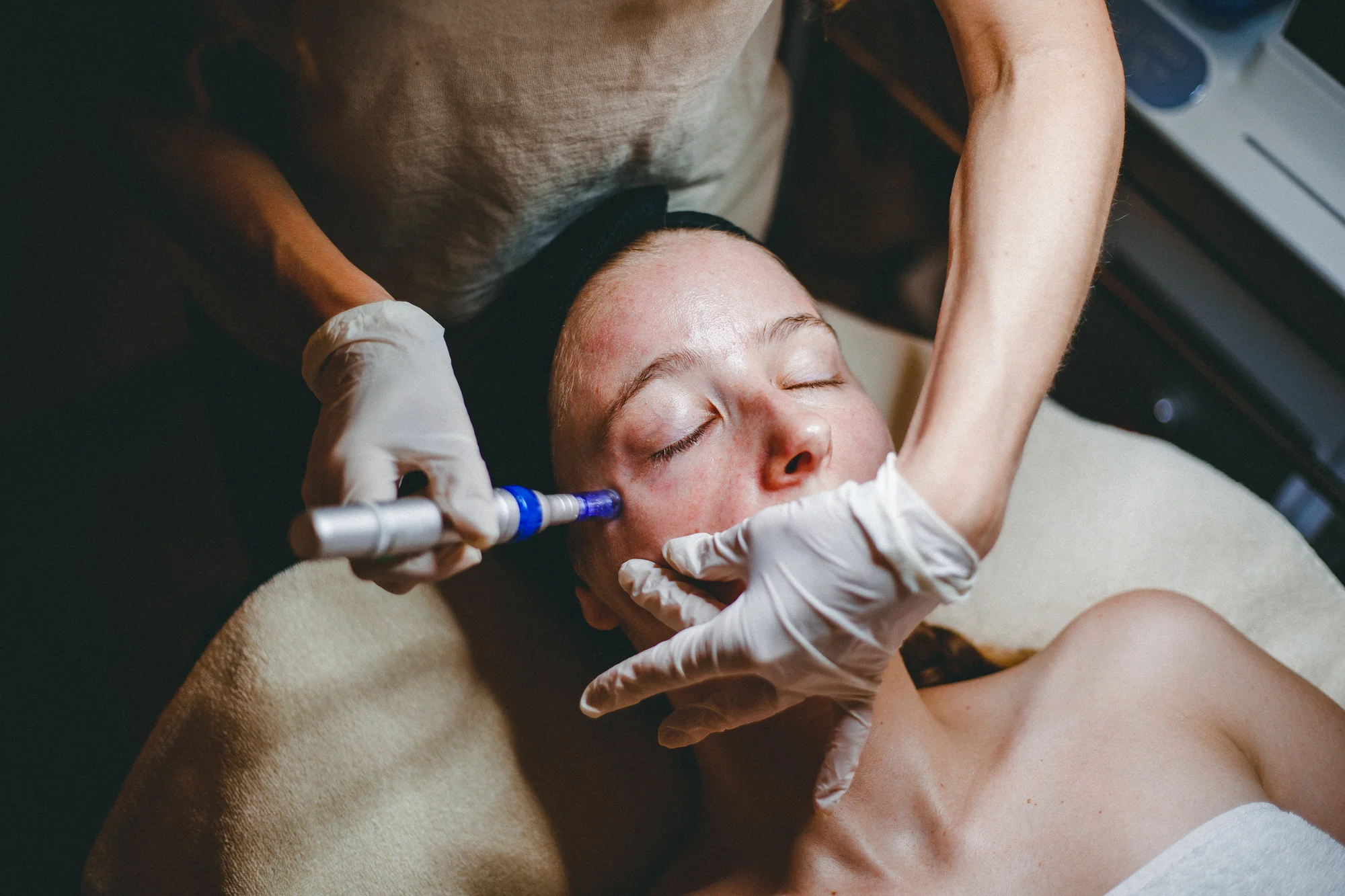 Čistenie pleti, ošetrenie Hydrofacial alebo mezoterapia SkinBooster – Obrázok 2