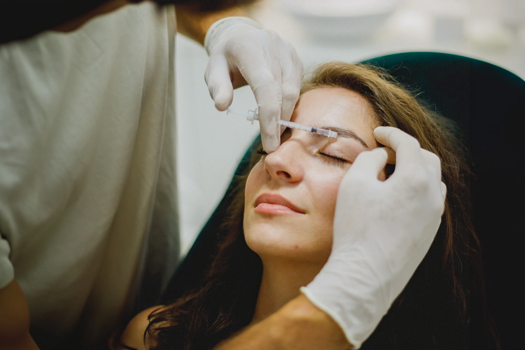 Aplikácia botulotoxínu, na výber 3 lokality aj Baby botox na celú tvár s korekciou – Obrázok 6