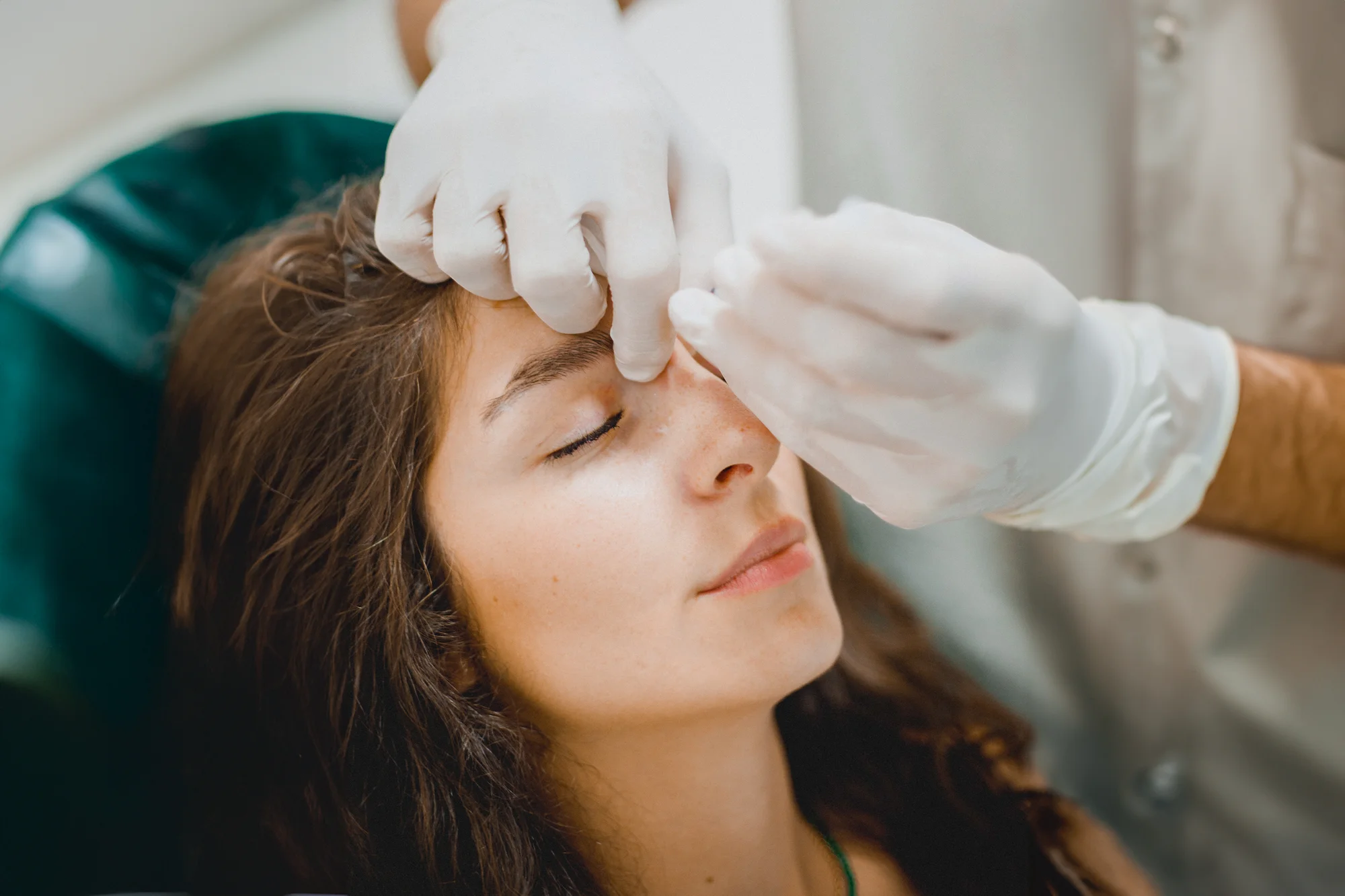 Aplikácia botulotoxínu, na výber 3 lokality aj Baby botox na celú tvár s korekciou – Obrázok 5