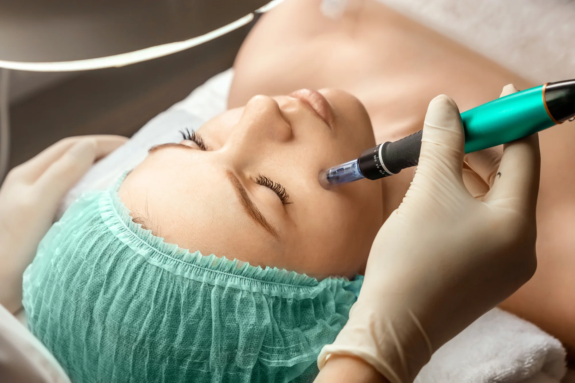 Čistenie pleti s ultrazvukom, ošetrenie s galvanickou žehličkou alebo microneedling dermapenom – Obrázok 3