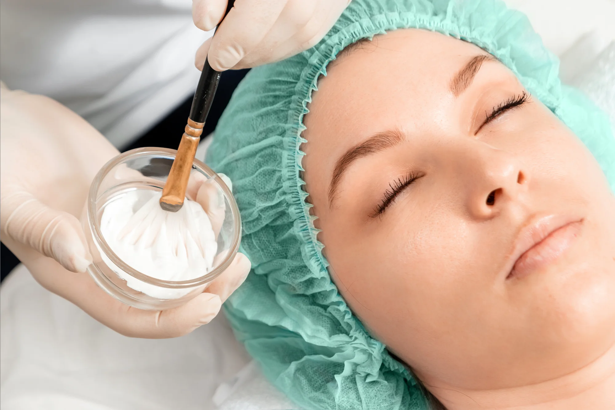 Čistenie pleti s ultrazvukom, ošetrenie s galvanickou žehličkou alebo microneedling dermapenom – Obrázok 5