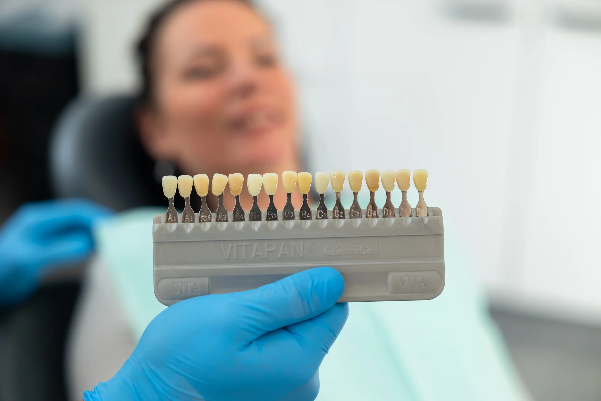 Dentálna hygiena pre deti a dospelých alebo profesionálne ambulantné bielenie zubov – Obrázok 5