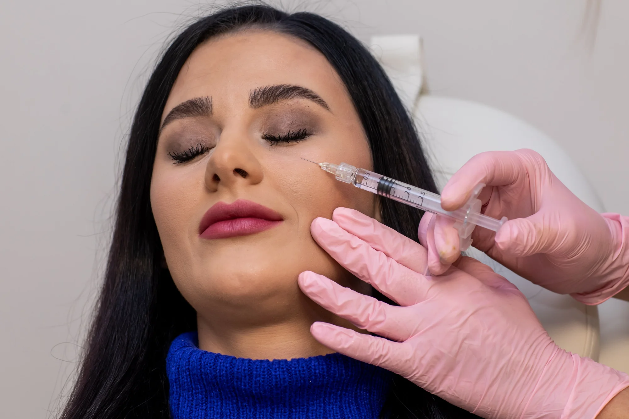 Aplikácia botulotoxínu do oblasti tváre v Neuroderm: Jedna, dve či tri lokality – Obrázok 2