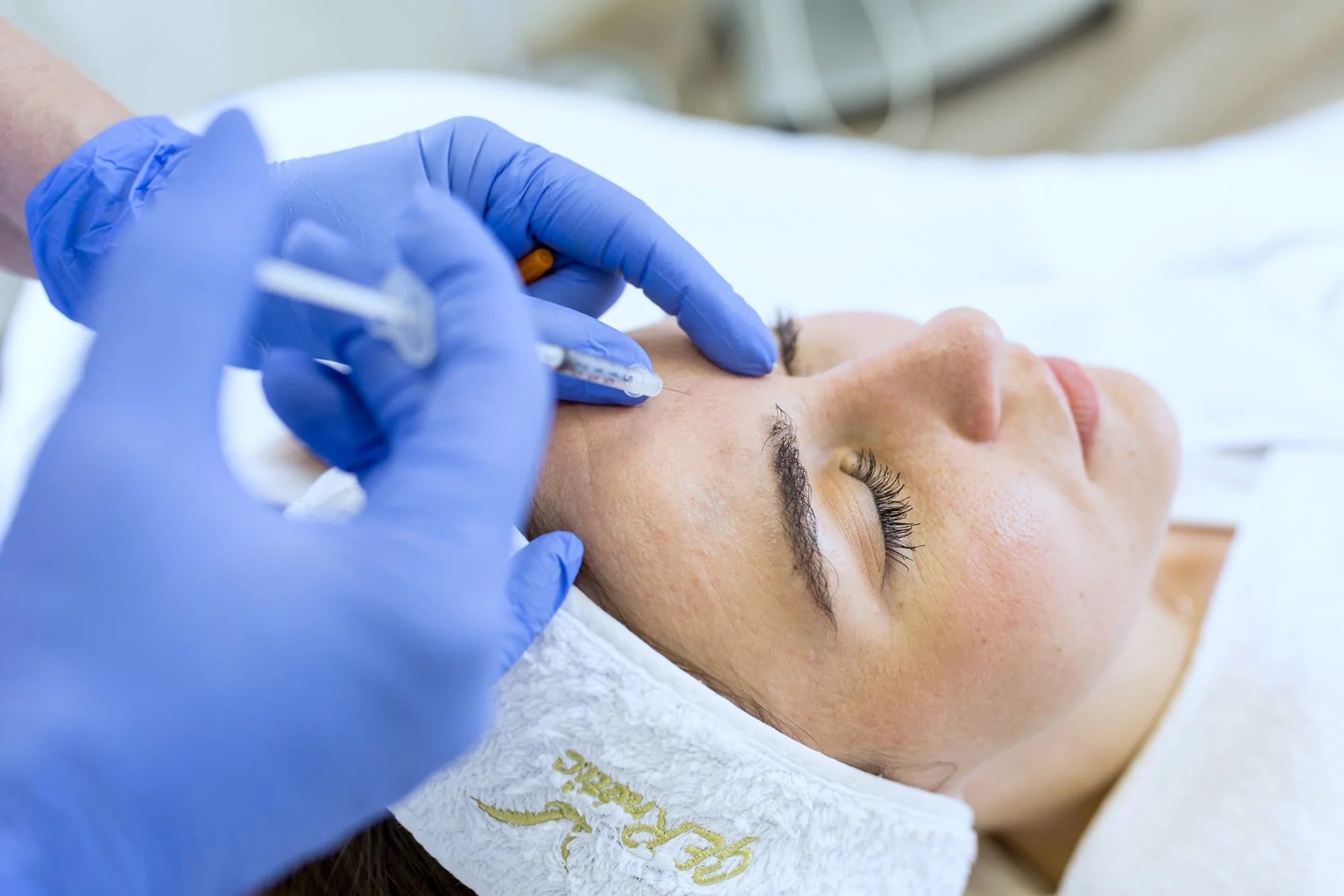 Omladzujúci botox alebo kyselina hyalurónová pre zvodné pery – Obrázok 4