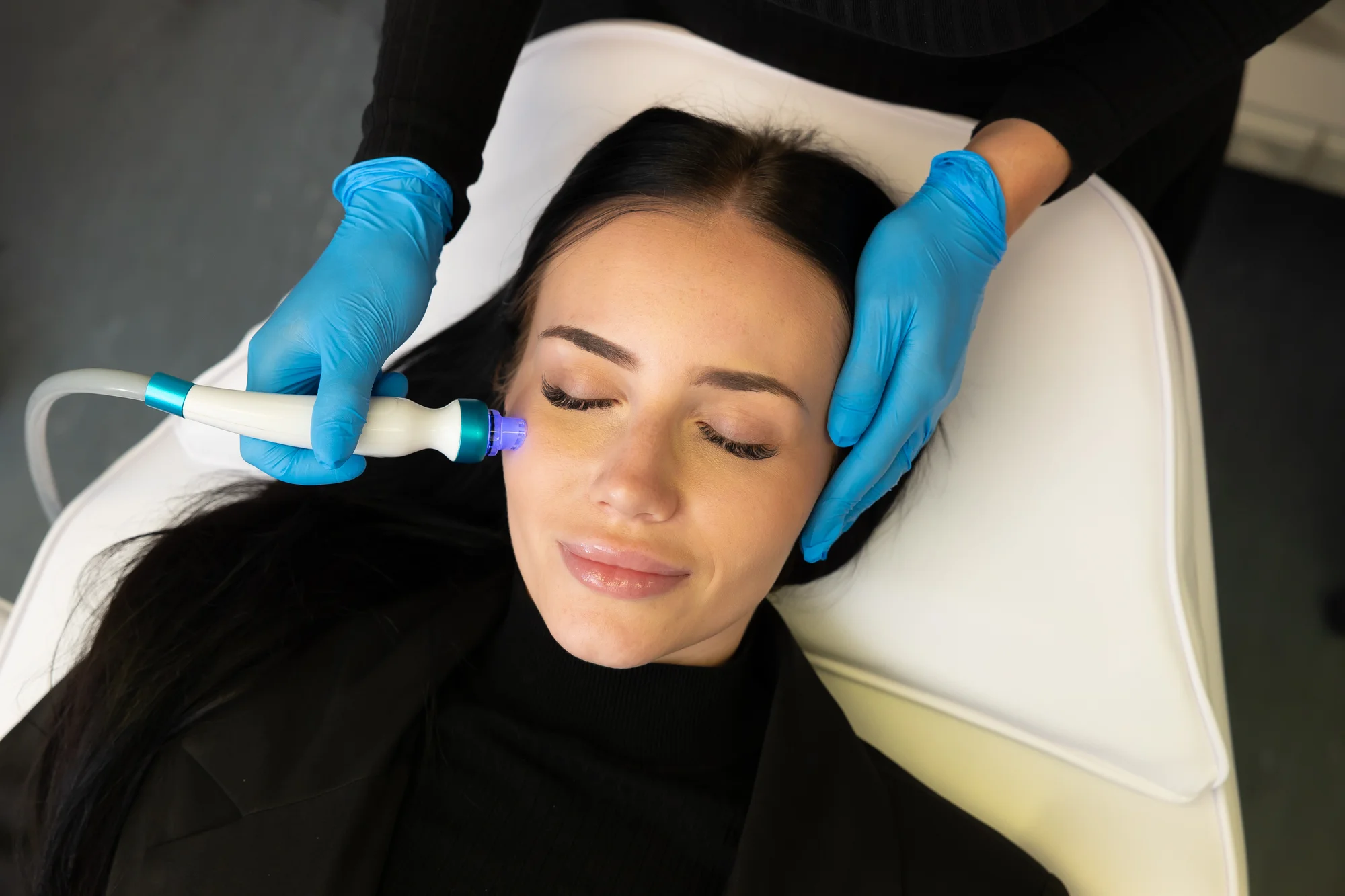 Hydrafacial: Unikátne rejuvenizačné ošetrenie pleti – Obrázok 4
