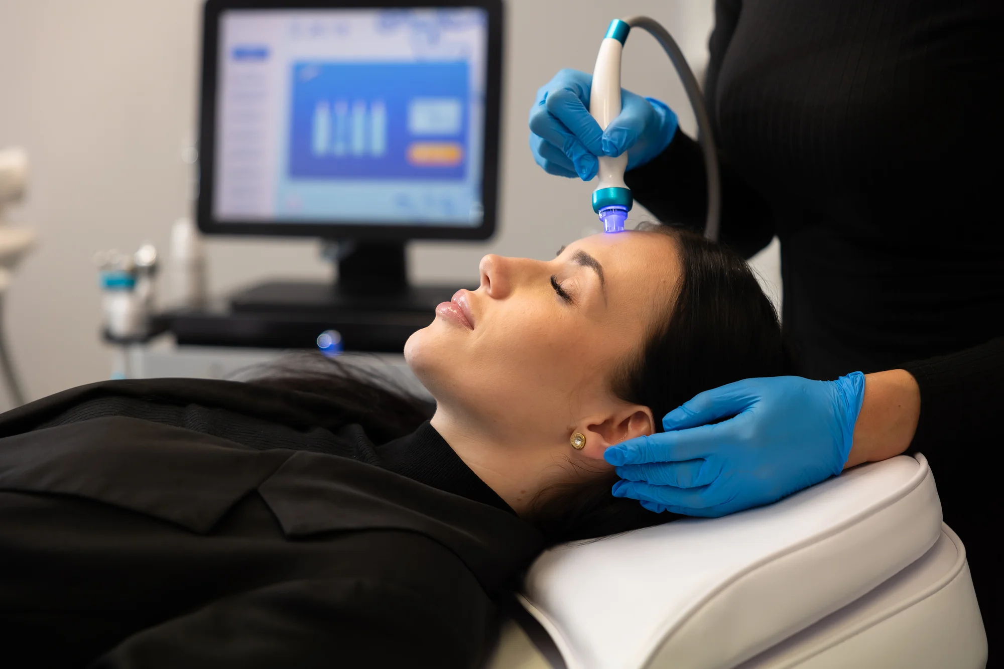 Hydrafacial: Unikátne rejuvenizačné ošetrenie pleti – Obrázok 3