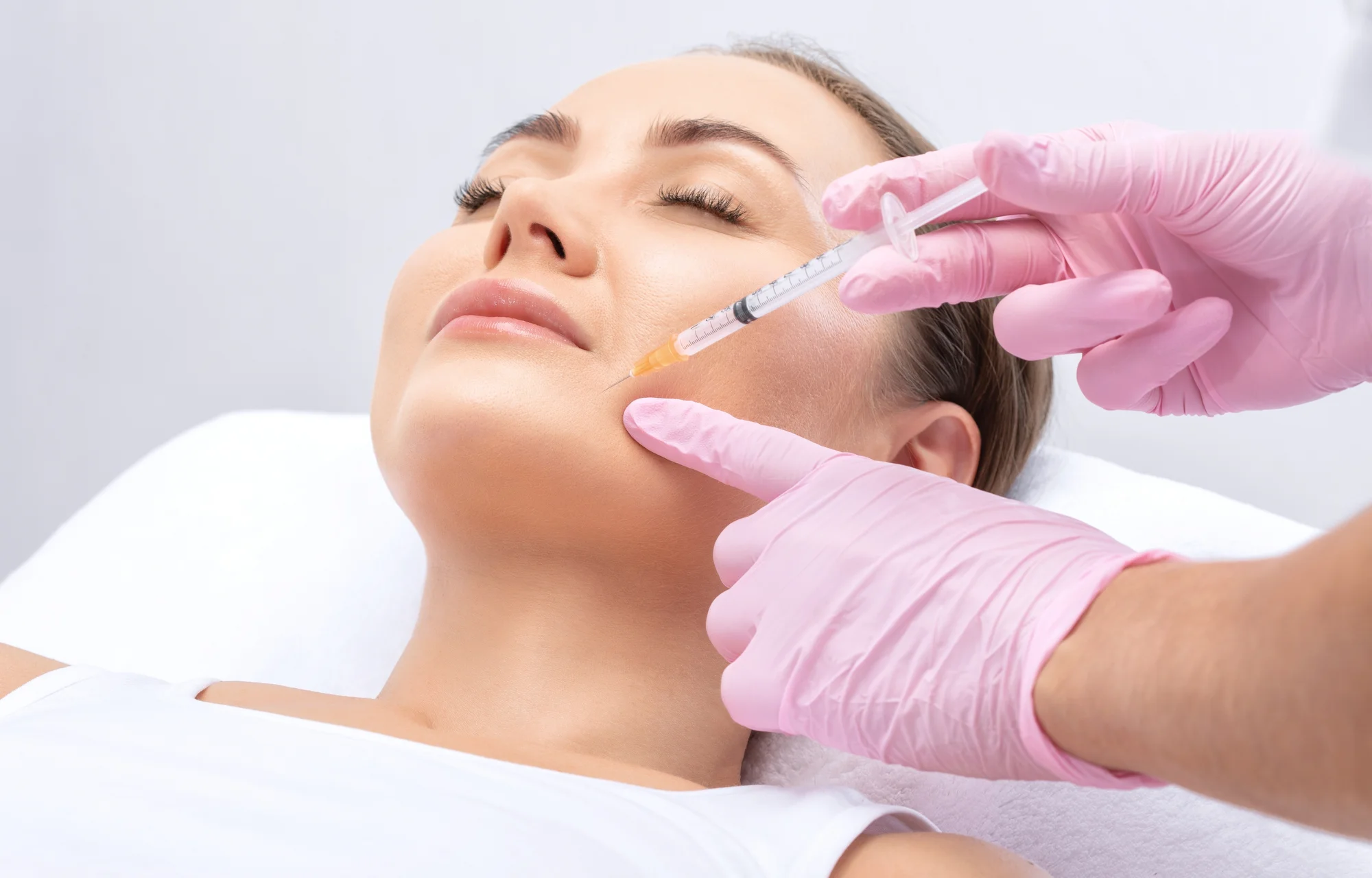 Ošetrenie Radiesse vo Vultus Clinic: Vysoko účinnný lifting a stimulácia kolagénu bez chirurgického zákroku – Obrázok 5
