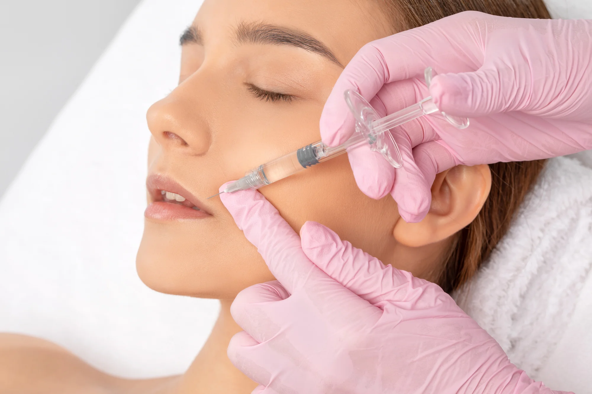 Ošetrenie Radiesse vo Vultus Clinic: Vysoko účinnný lifting a stimulácia kolagénu bez chirurgického zákroku – Obrázok 4