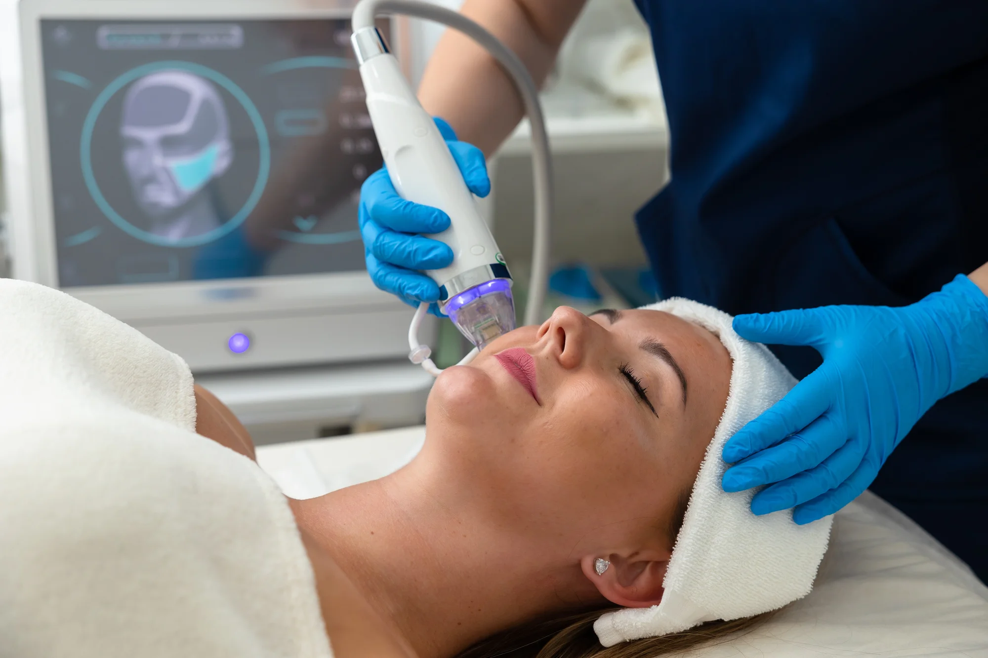 Medicínska mikroihličková frakčná rádiofrekvencia v salóne Krása štúdio – Obrázok 5