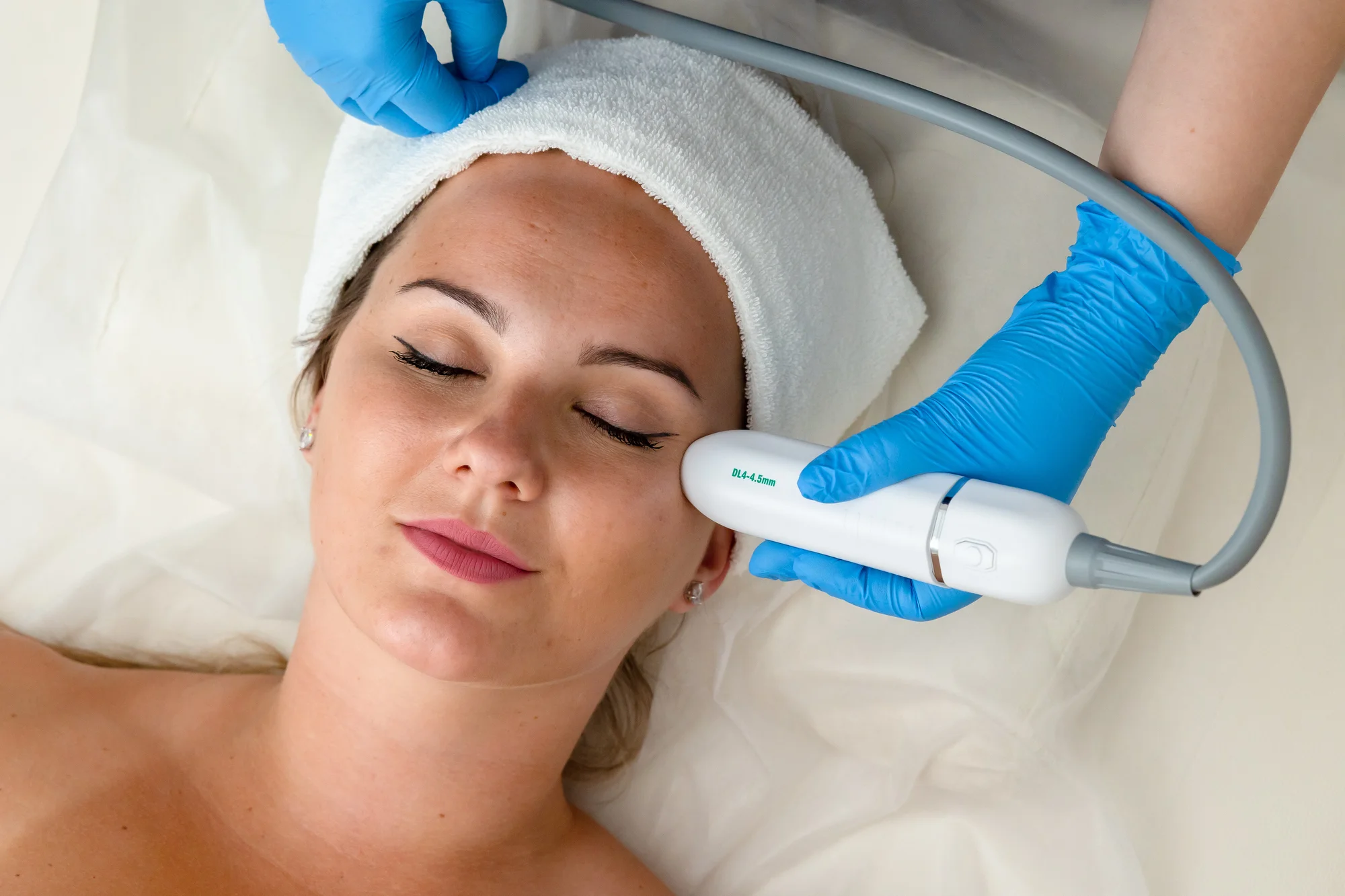 Zredukujte vrásky a napnite pokožku s neinvazívnym faceliftingom Hifu Ultherapy – očné okolie a čelo, dekolt, krk a podbradok alebo celá tvár! – Obrázok 3