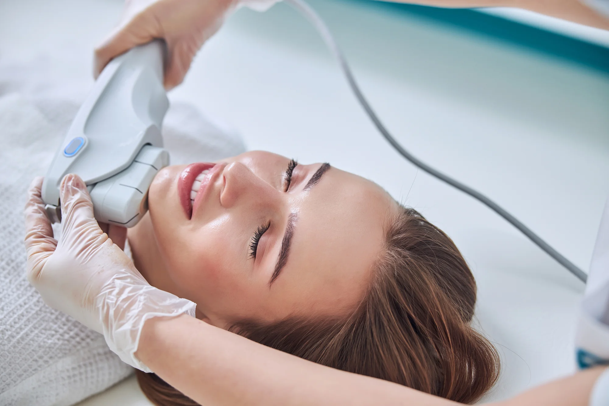 HIFU Ultherapy: Nechirurgický lifting čela, očného okolia, krku aj podbradku – Obrázok 4
