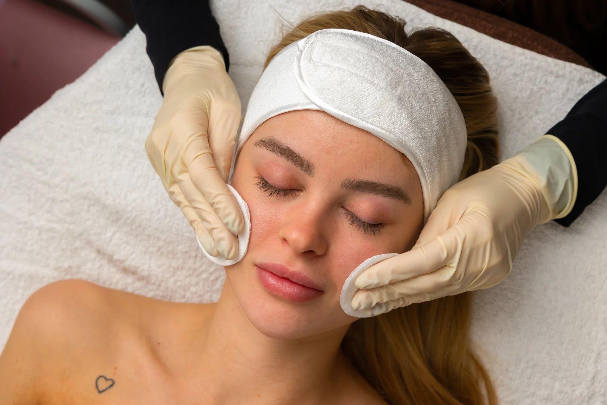 Chemický peeling, microneedling, Vitamin Power C, rádiofrekvencia tváre, lashlift, laminácia a i. – Obrázok 2