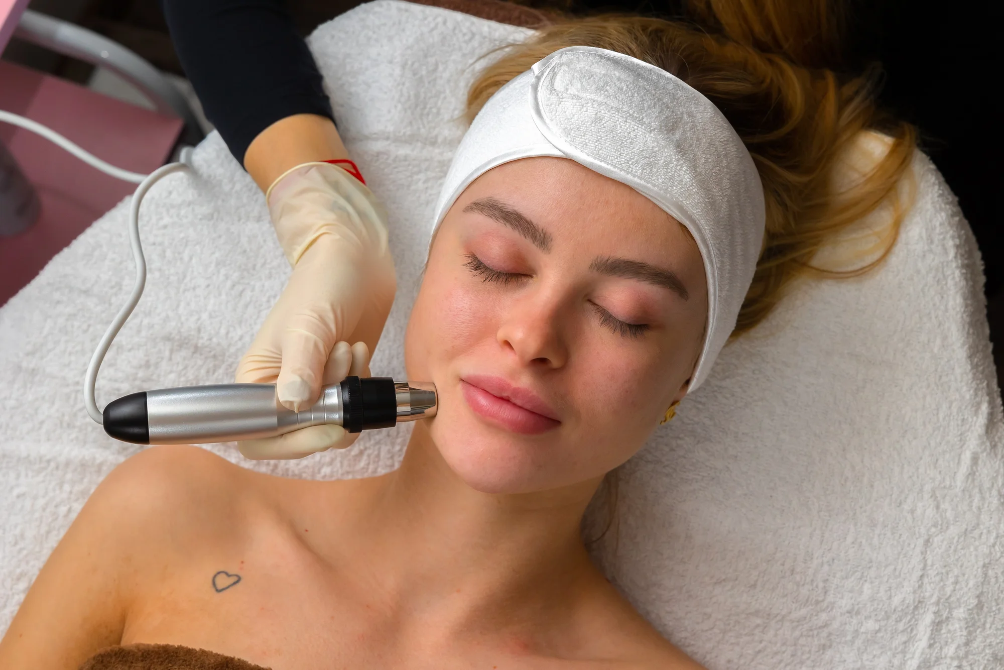 Chemický peeling, microneedling, Vitamin Power C, rádiofrekvencia tváre, lashlift, laminácia a i. – Obrázok 4