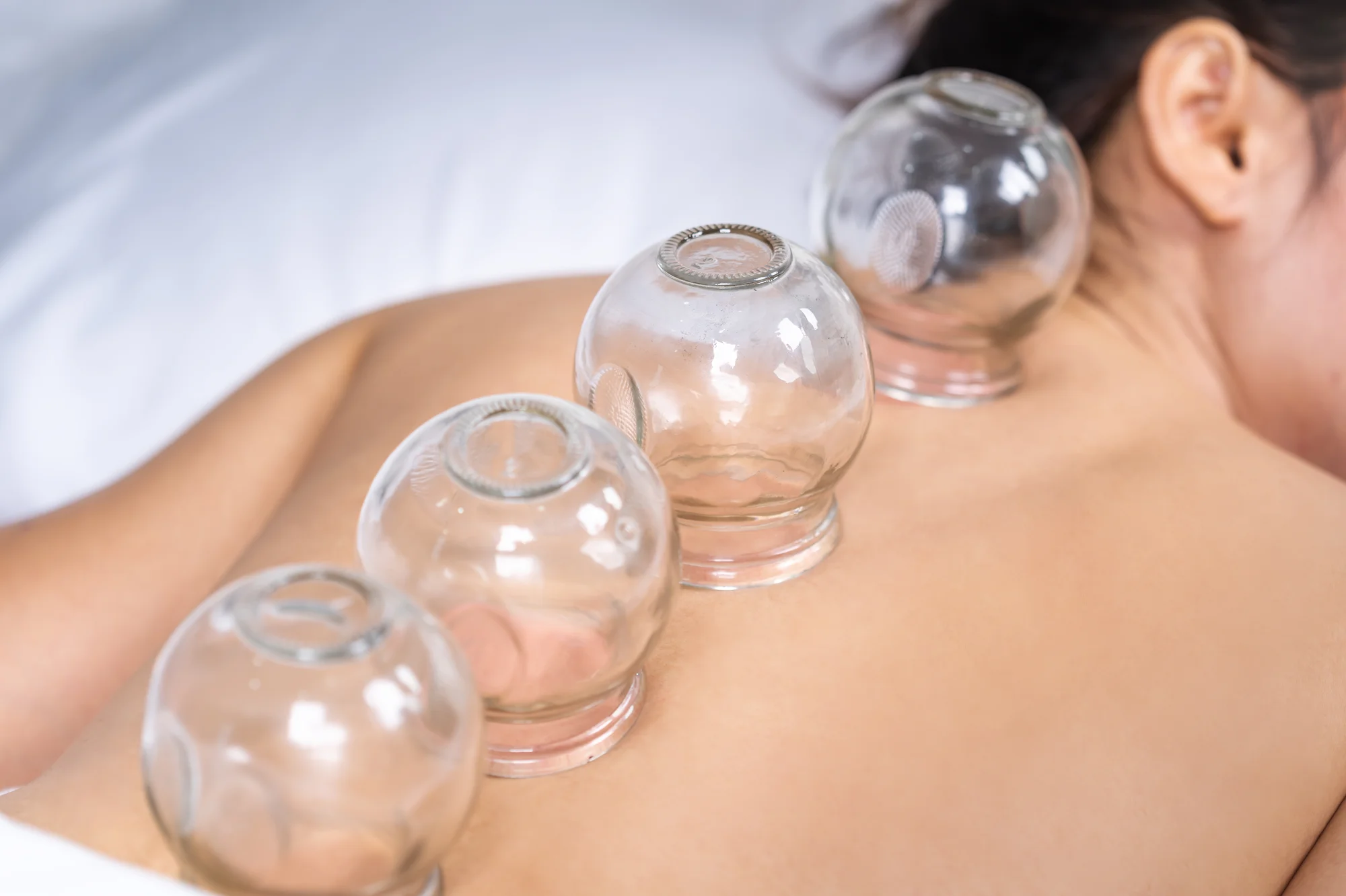 Bankovanie, klasická, myofasciálna alebo kombinovaná masáž – Obrázok 3