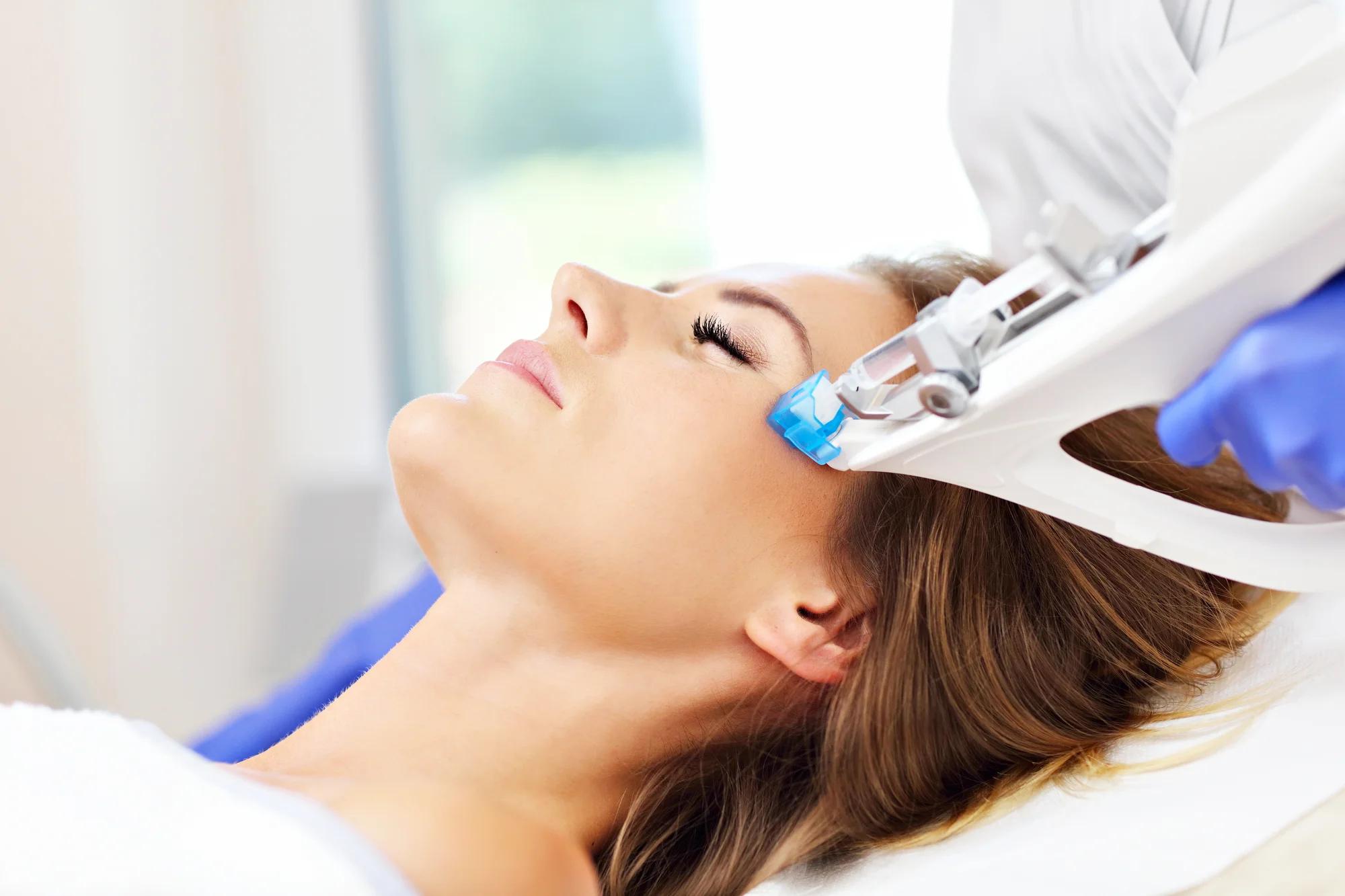 Mezoterapia kyselinou hyalurónovou pomocou Vital Injectora – Obrázok 2